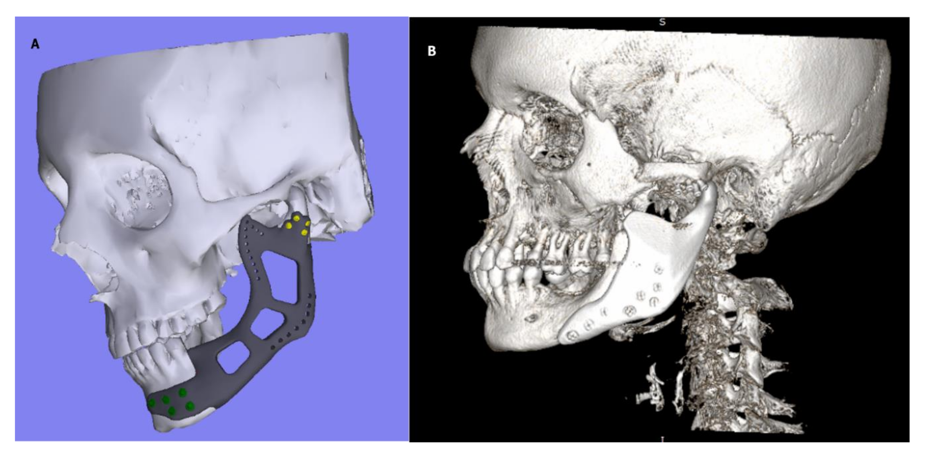 Jfb 12 00007 g001 Jfb 12 00007 g001