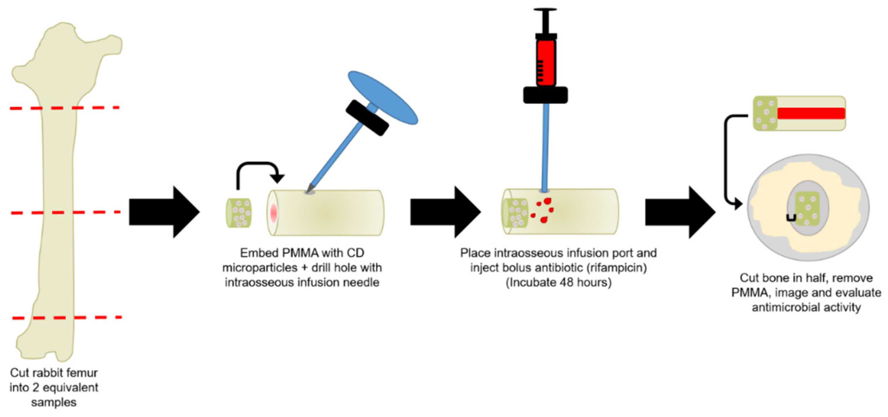 JFB Free FullText Poly(methyl methacrylate) Bone Cement Composite