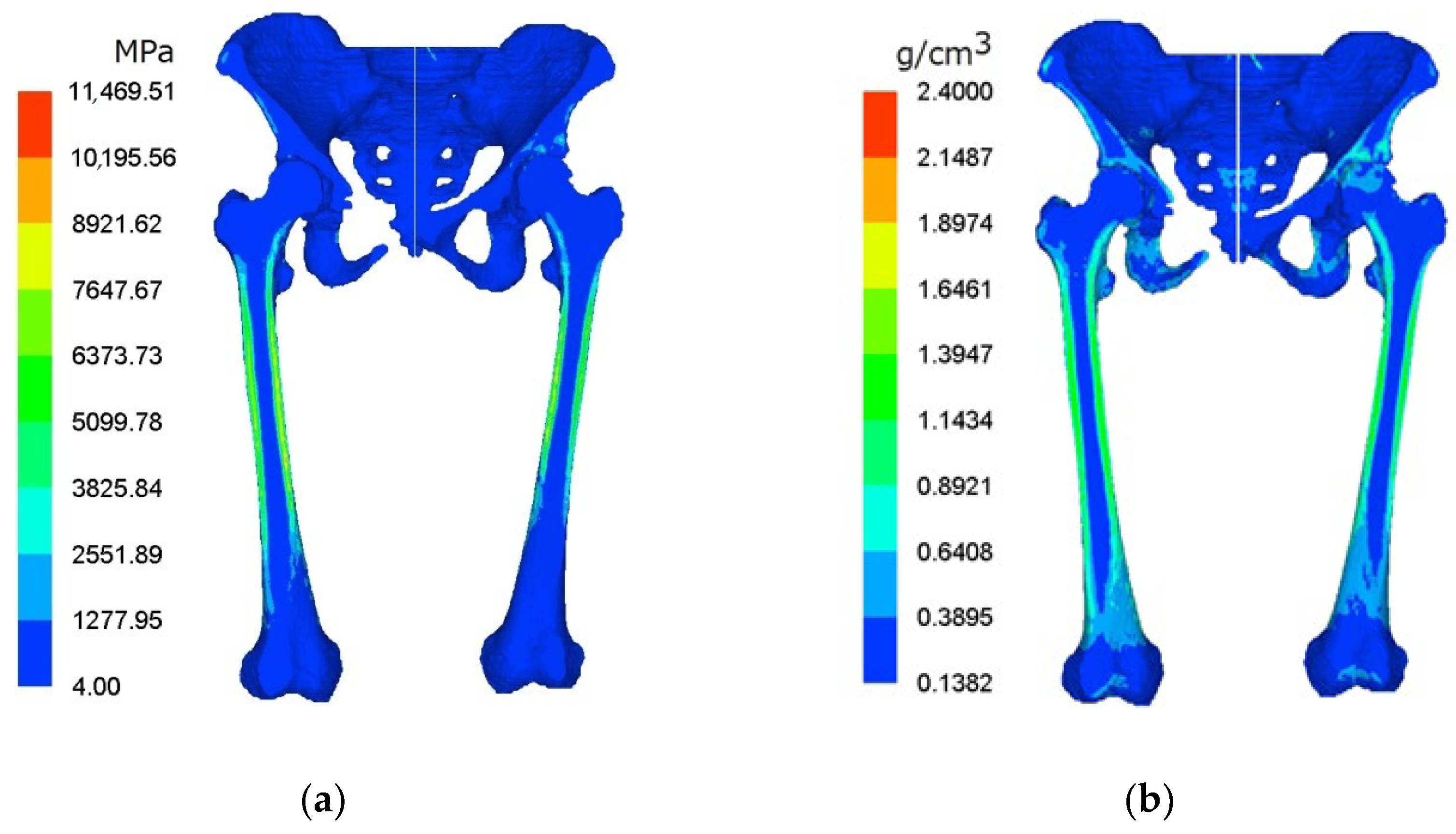 femur-pelvis