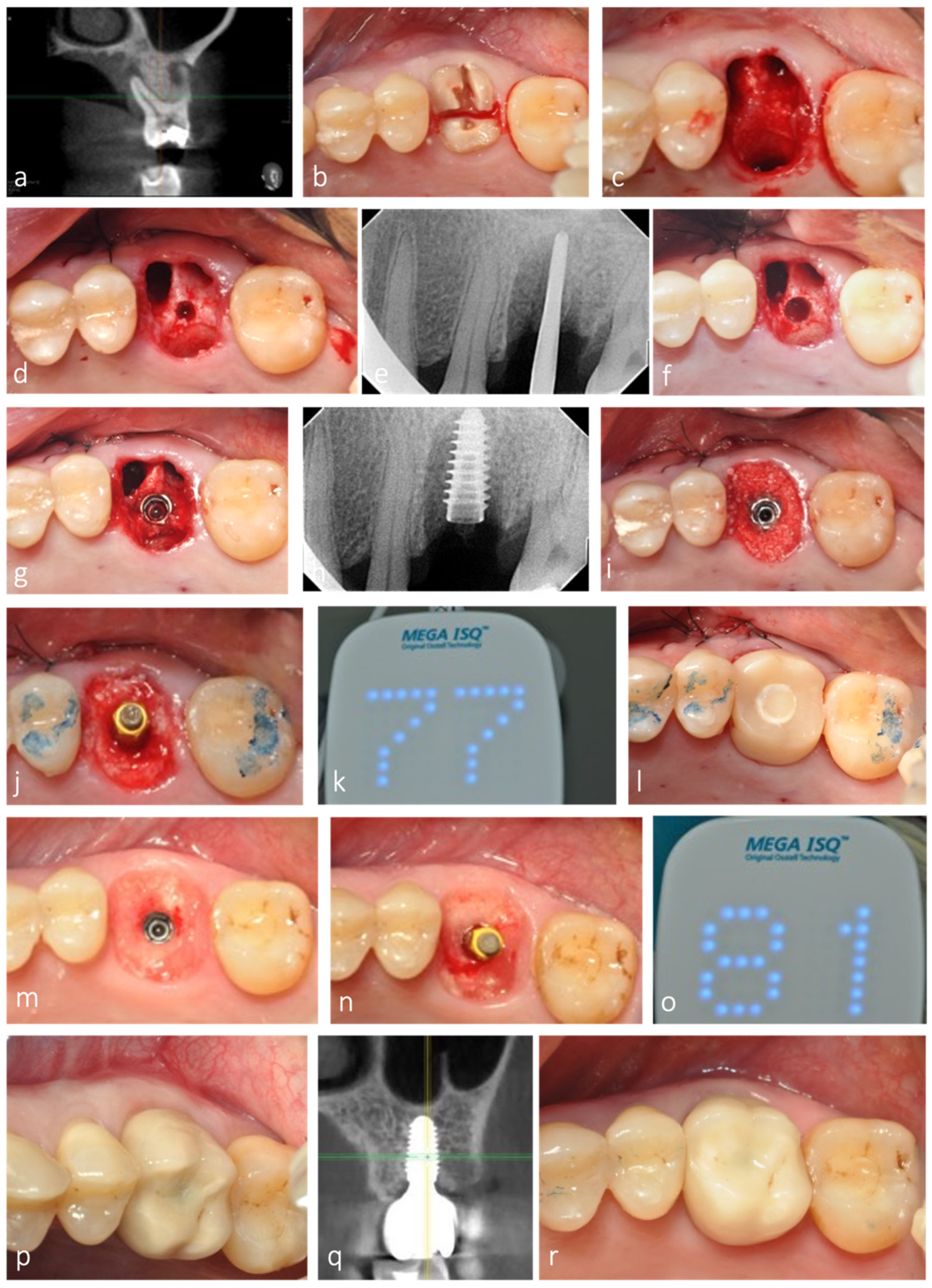 Jfb 12 00066 g008 550