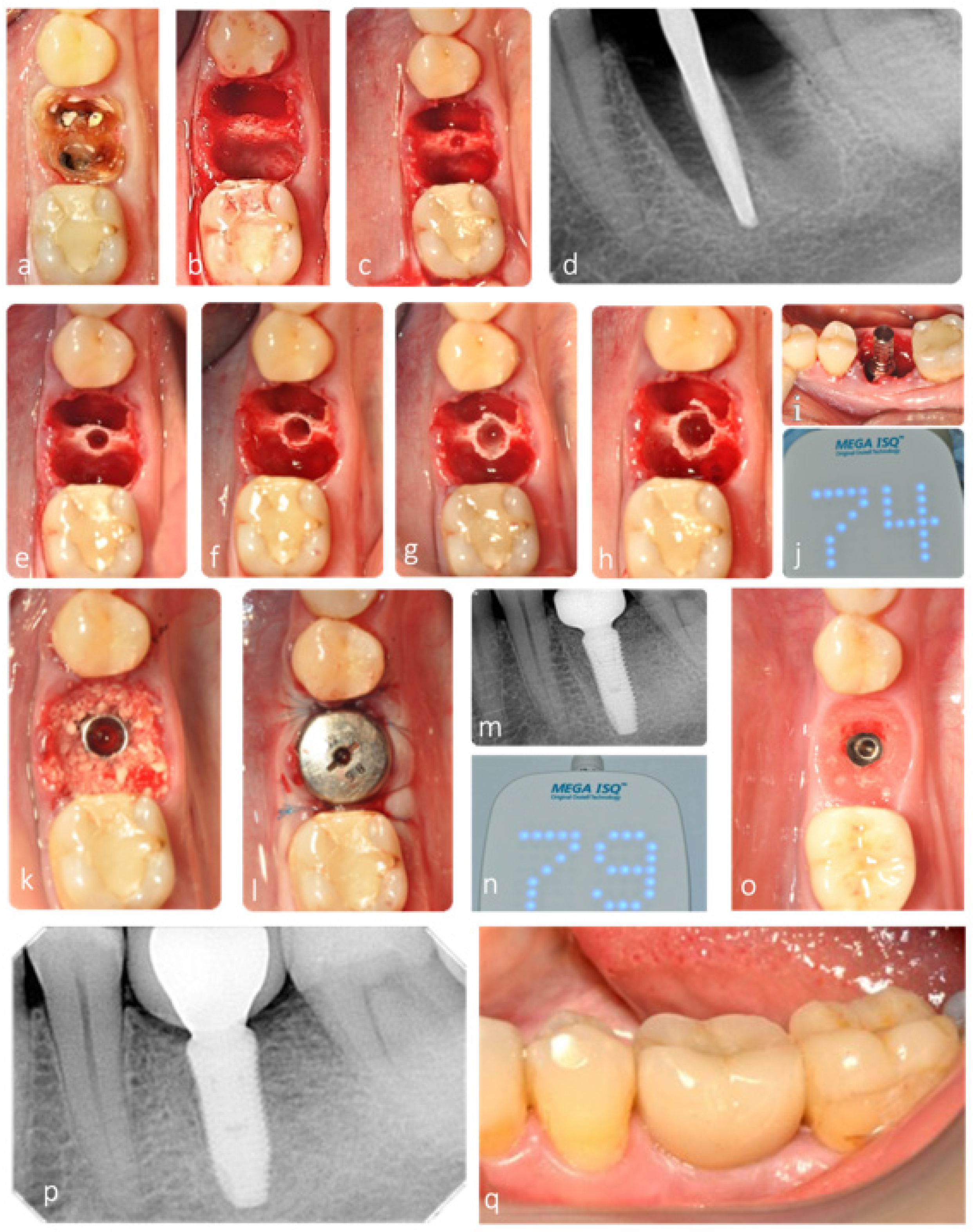 Jfb 12 00066 g009 550