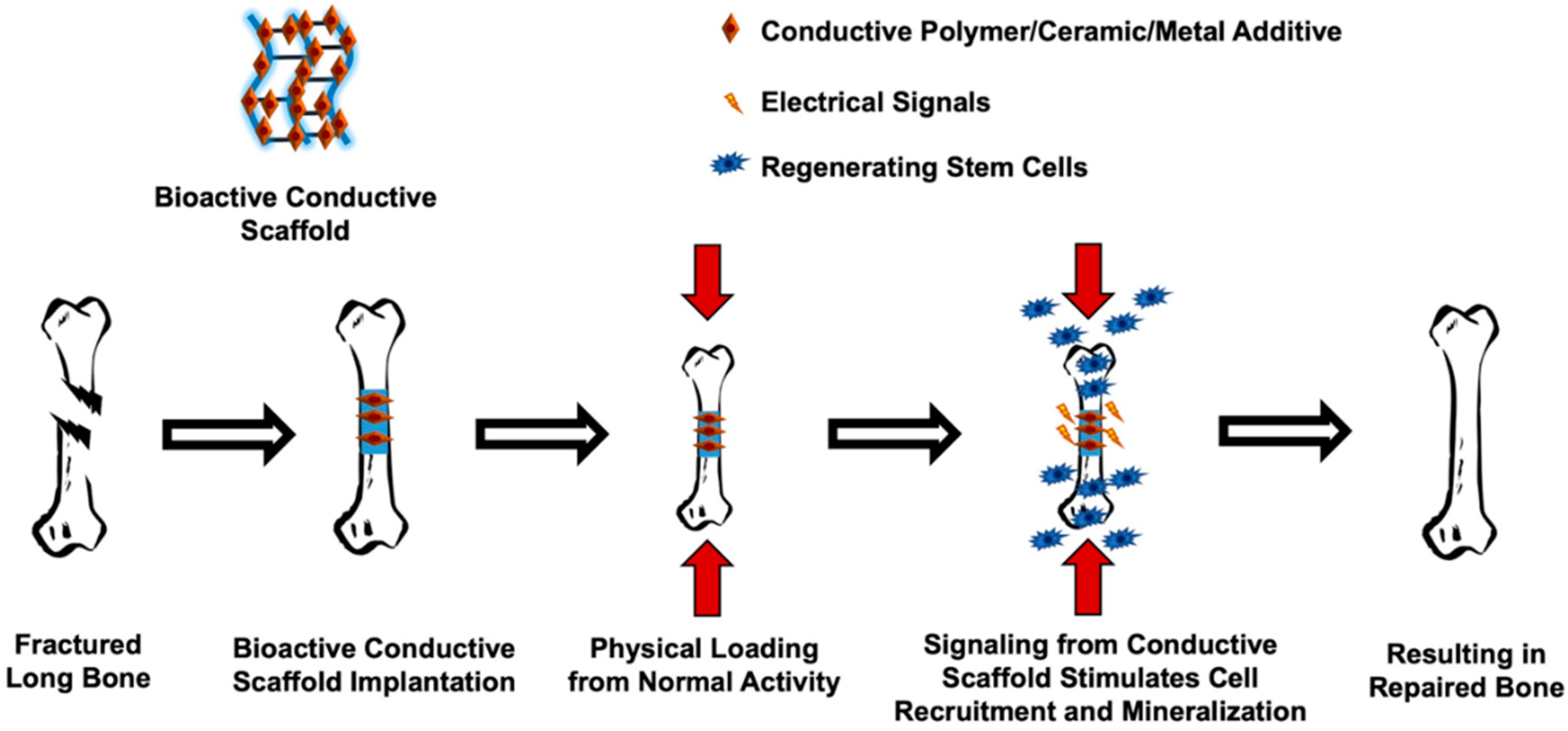 JFB | Free Full-Text | Conductive Scaffolds for Bone Tissue Engineering ...