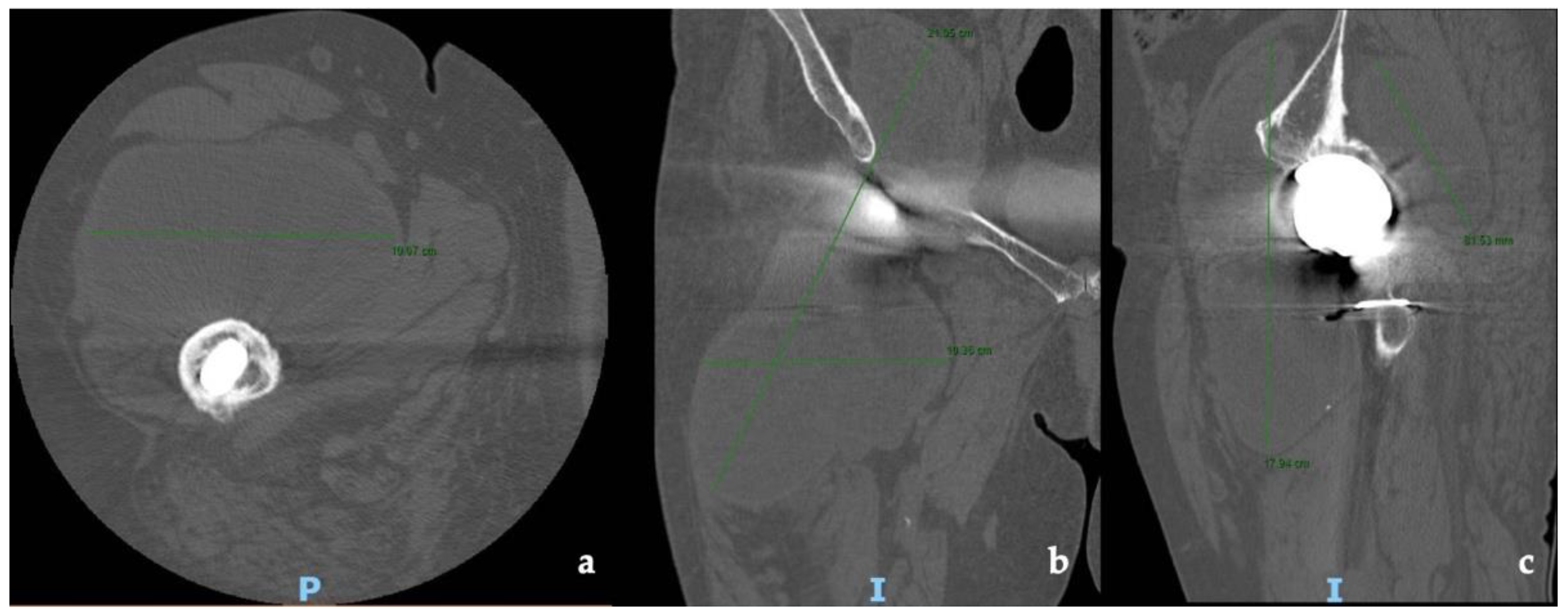 Jfb 13 00145 g002 Jfb 13 00145 g002