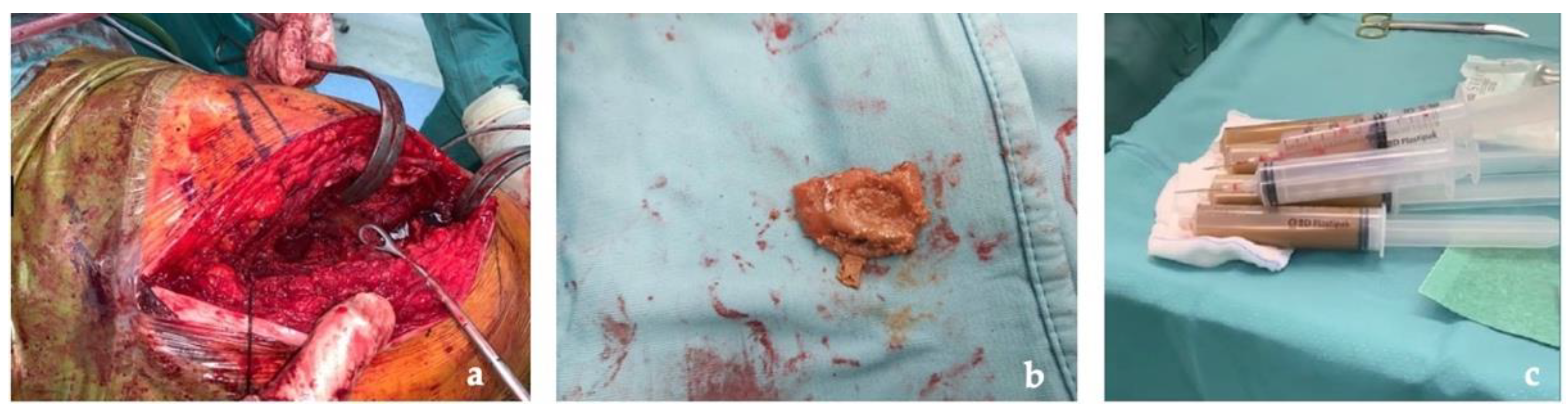 Jfb 13 00145 g004 Jfb 13 00145 g004