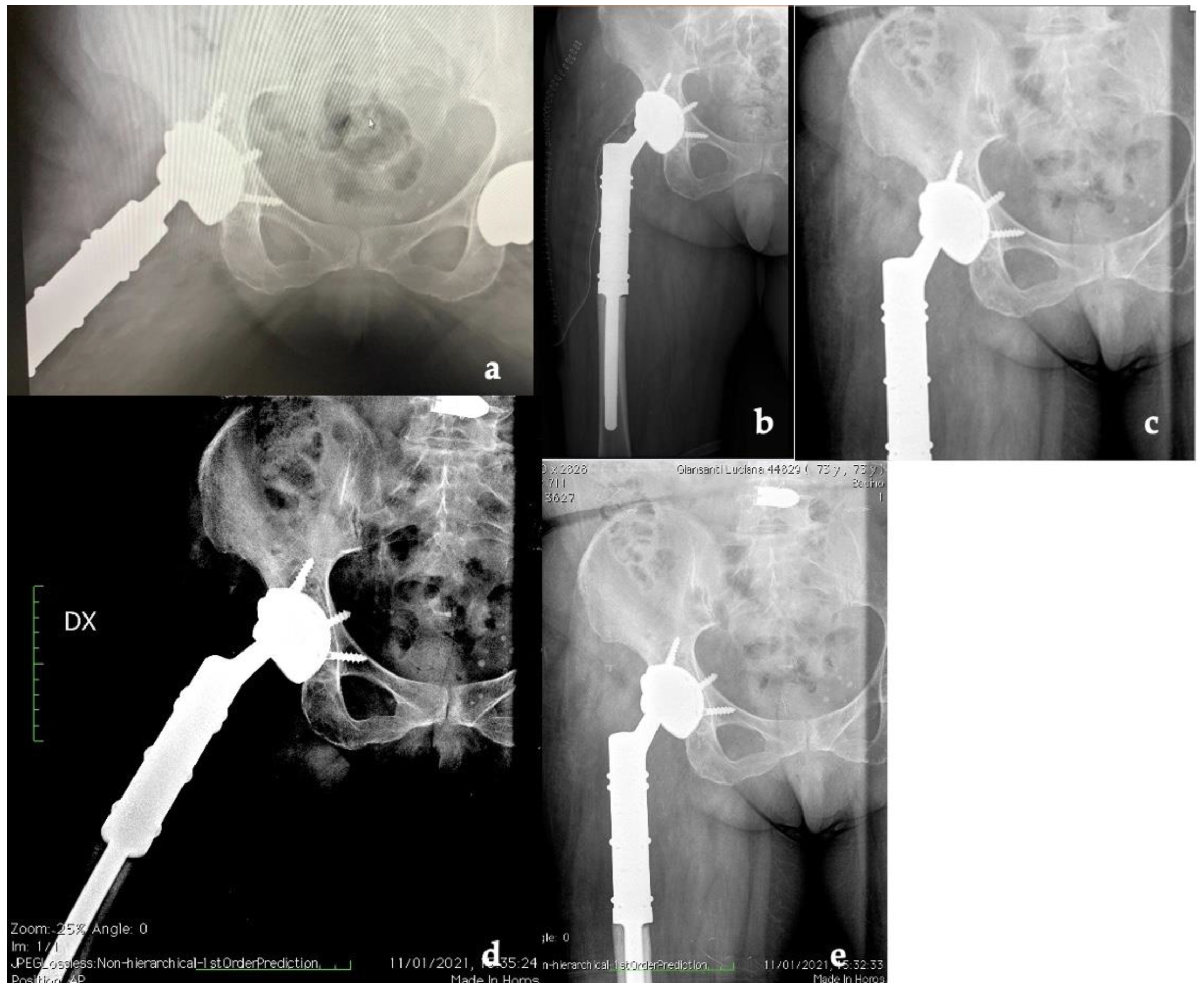 Jfb 13 00145 g006 Jfb 13 00145 g006