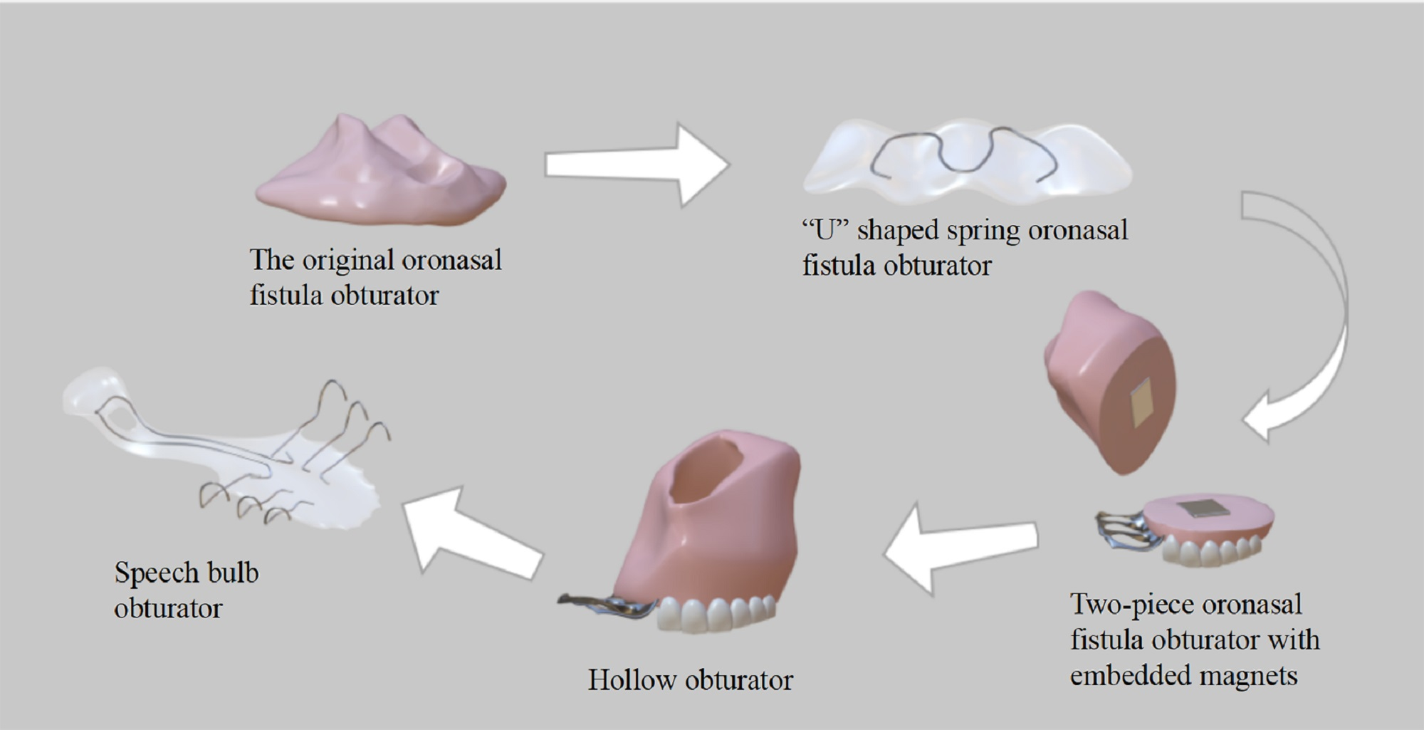 JFB Free FullText Obturator Manufacturing for Oronasal Fistula