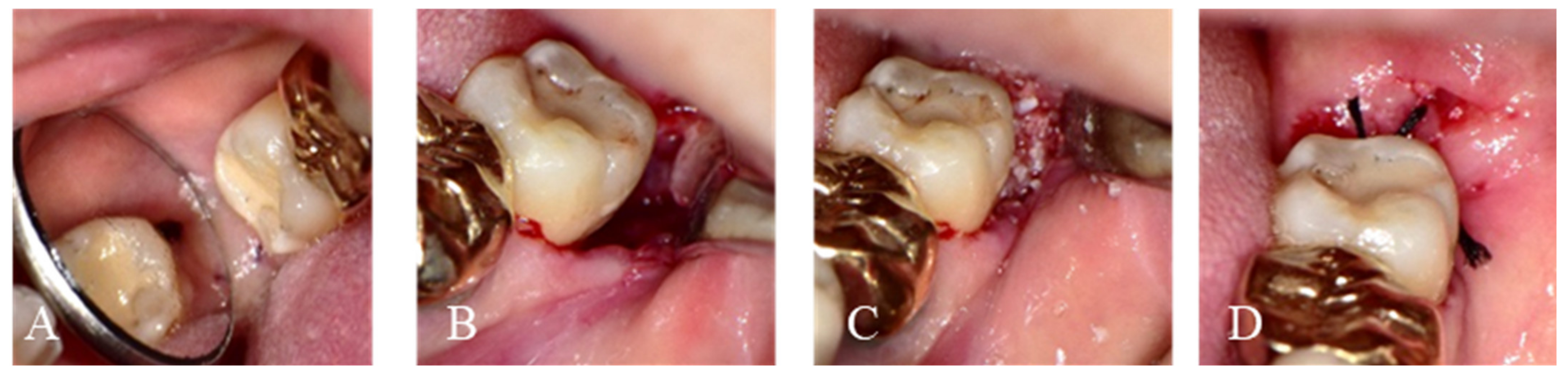 Jfb 14 00004 g002 Jfb 14 00004 g002