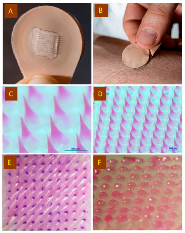 Jfb 14 00016 g003 Jfb 14 00016 g003