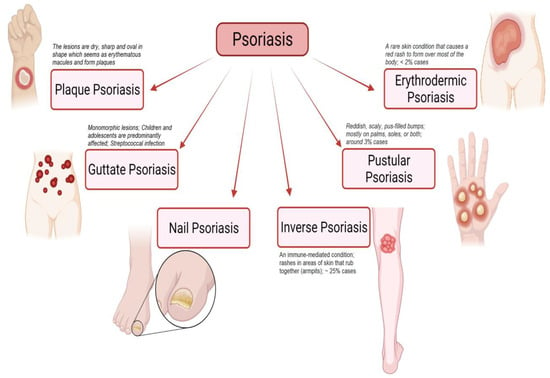 Psoriasis Treatment Market to hit USD 60.5 billion by 2032, says Global  Market Insights Inc.