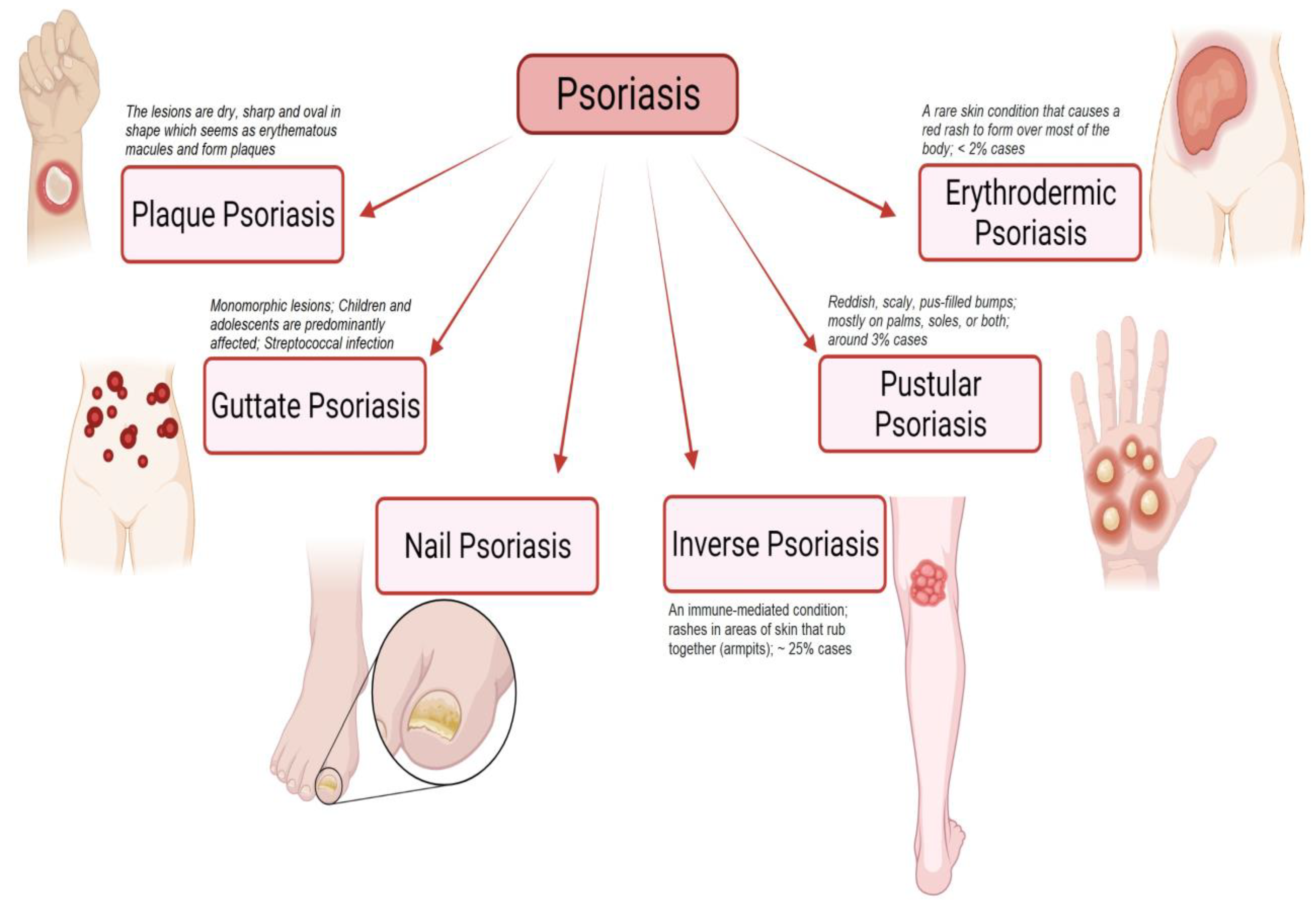 Nail Psoriasis or Fungus? How to know? When to see a doctor?