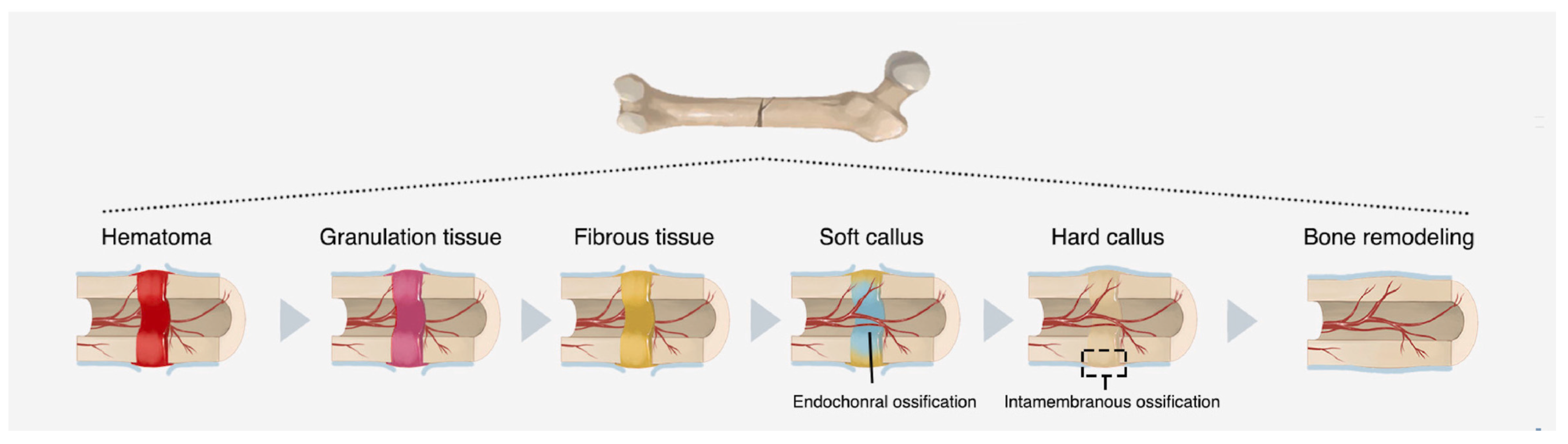 Jfb 14 00023 g002 Jfb 14 00023 g002