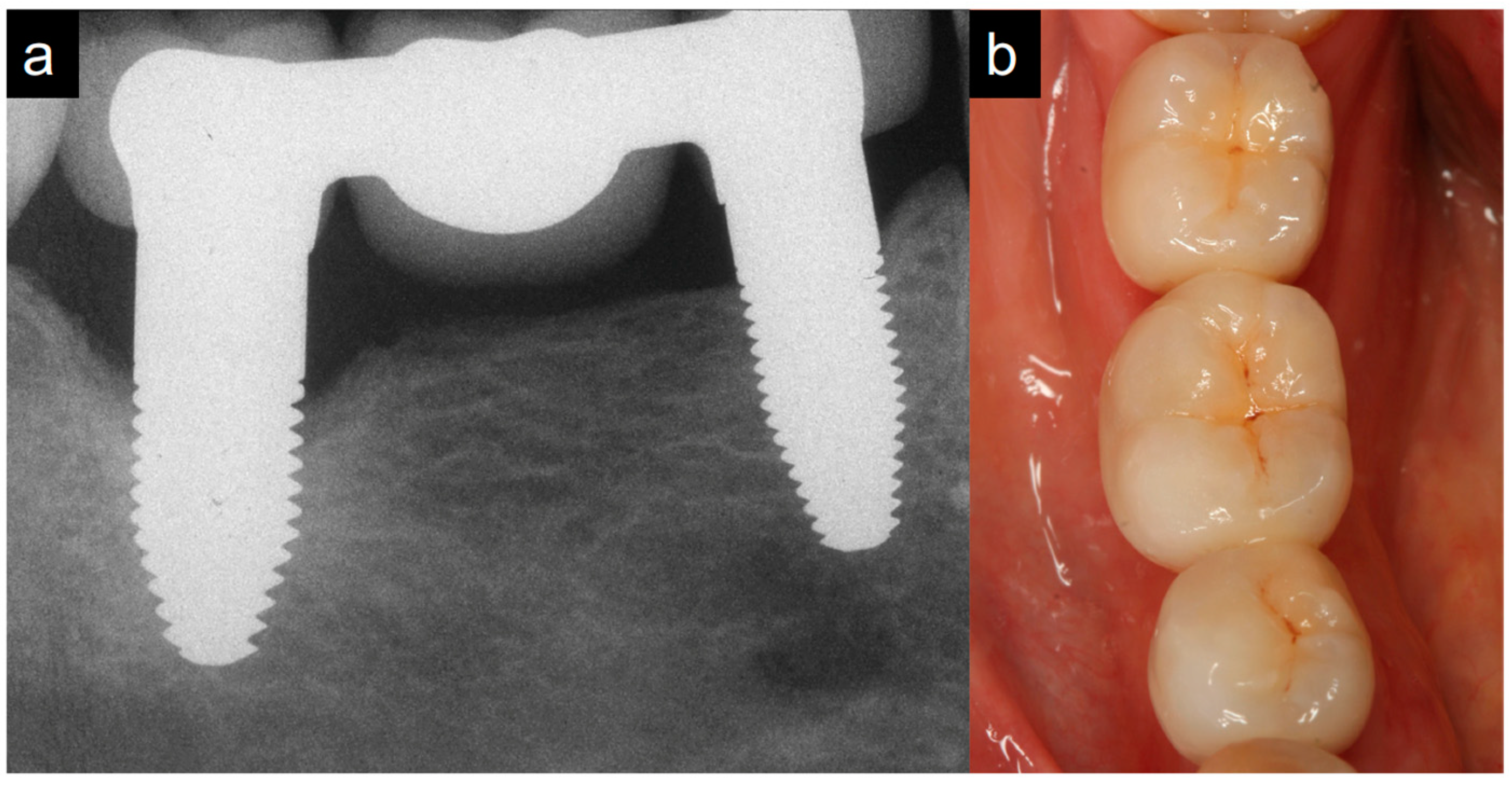Jfb 14 00045 g003 Jfb 14 00045 g003