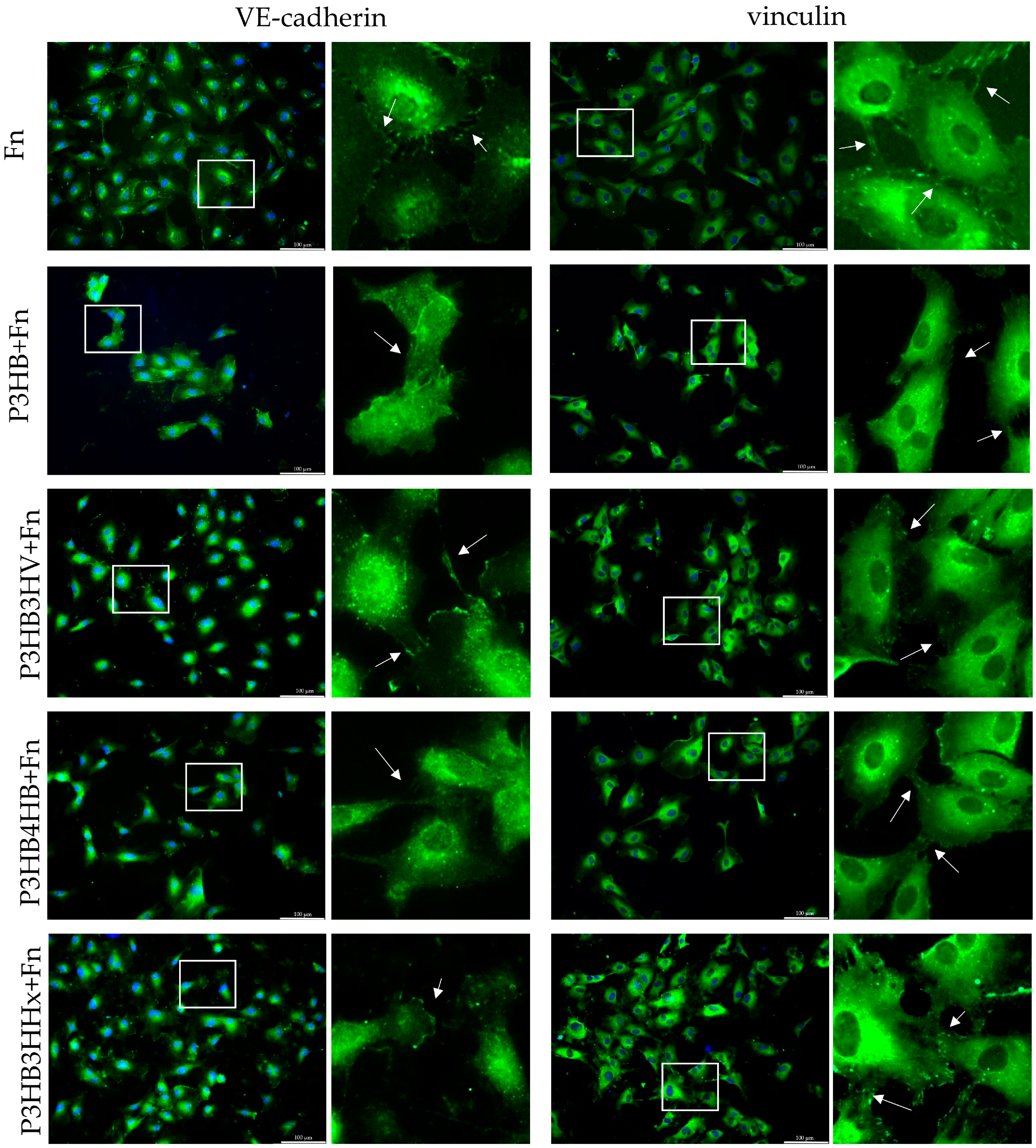 JFB | Free Full-Text | Influence of PHA Substrate Surface 