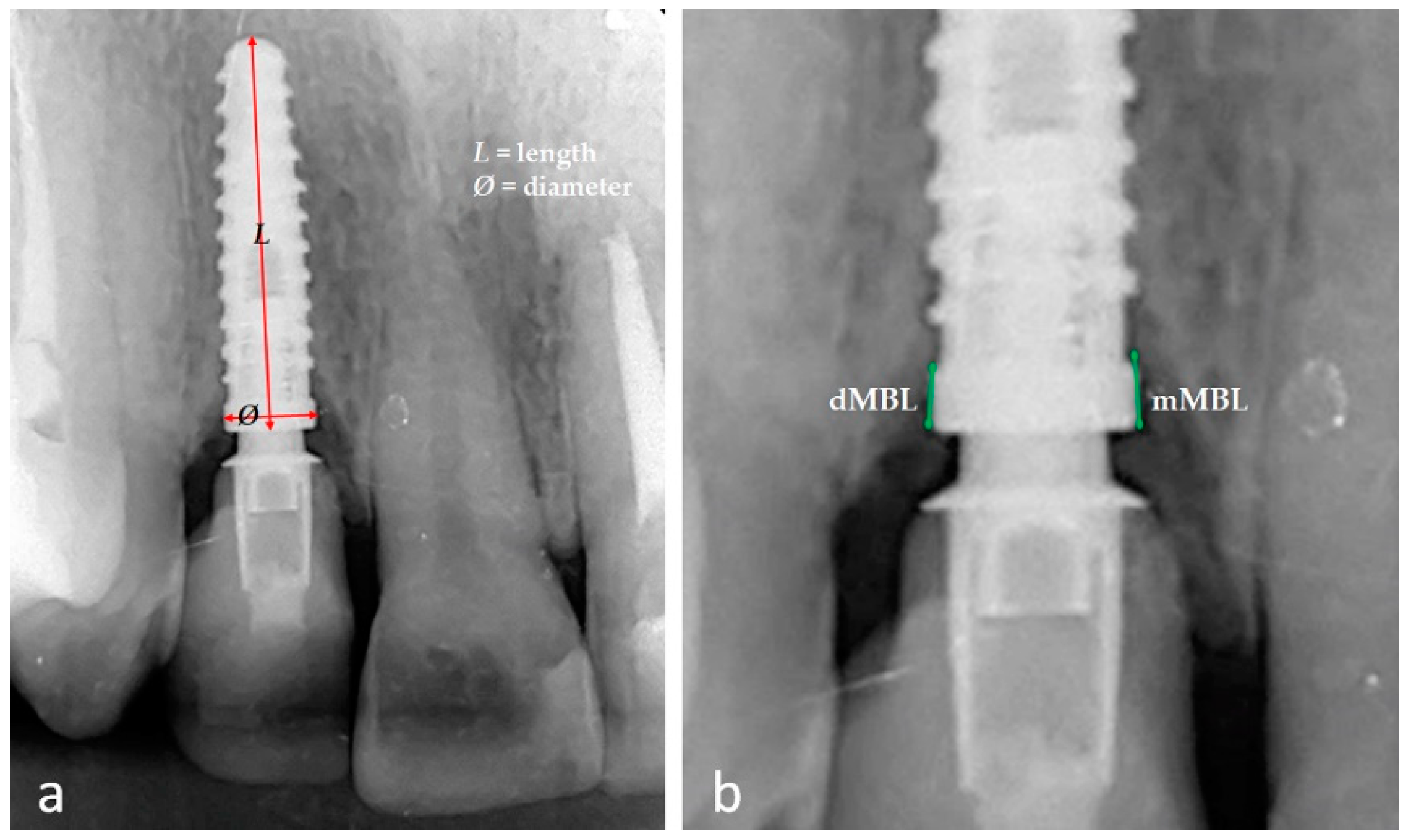 Jfb 14 00128 g003 Jfb 14 00128 g003