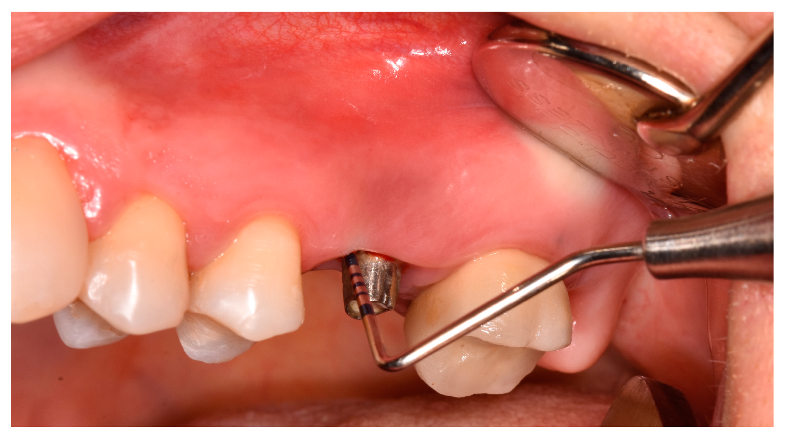 Jfb 14 00149 g002 Jfb 14 00149 g002