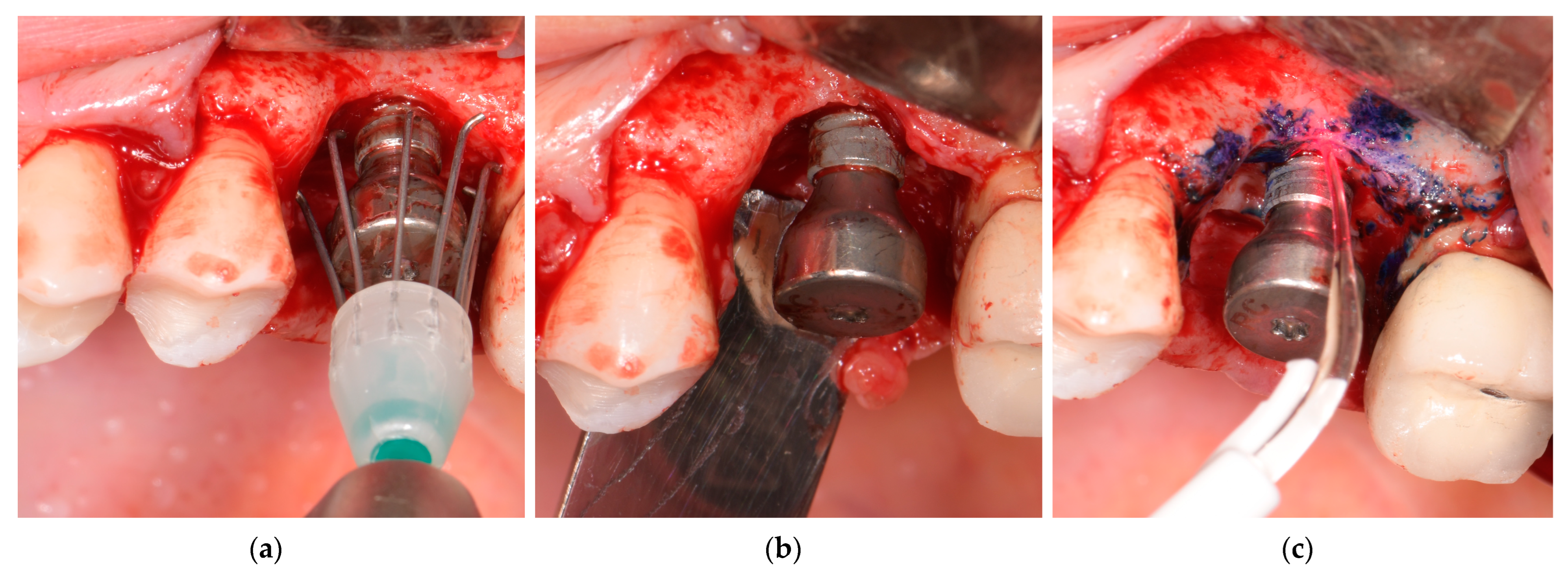 Jfb 14 00149 g003 Jfb 14 00149 g003