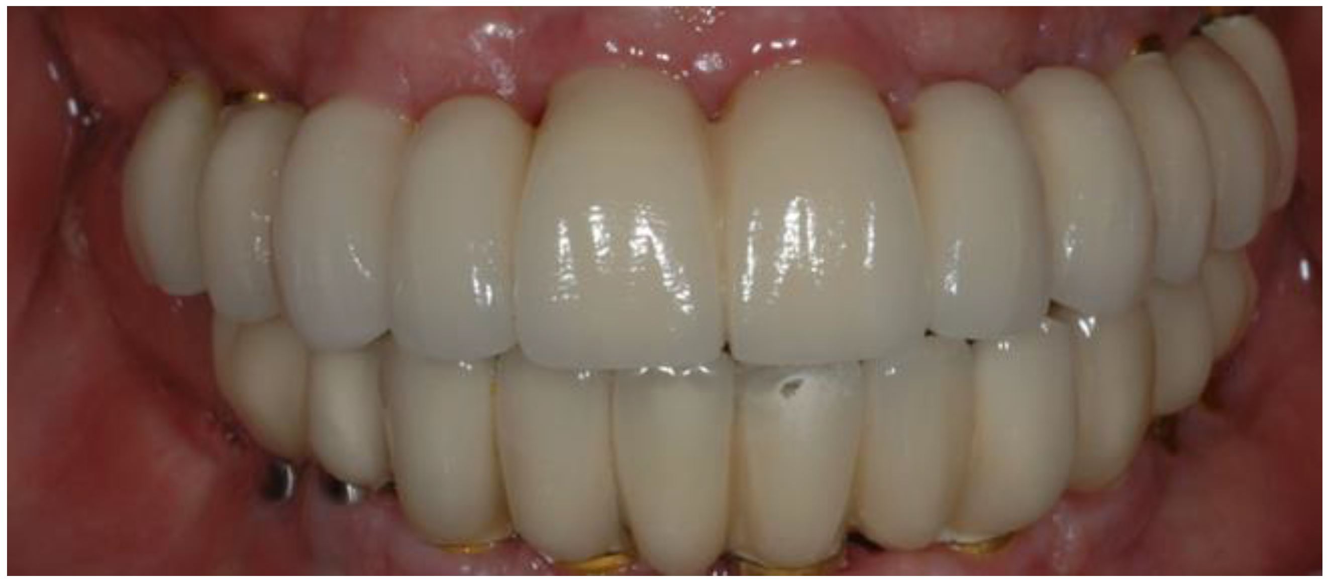 Jfb 14 00157 g003 Jfb 14 00157 g003