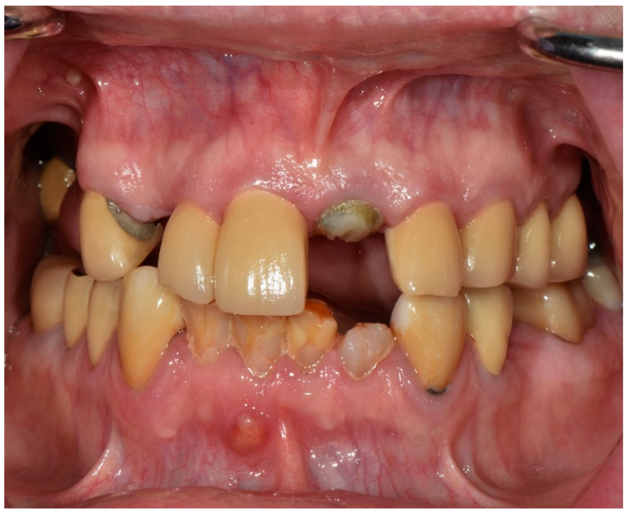 Jfb 14 00174 g002 Jfb 14 00174 g002