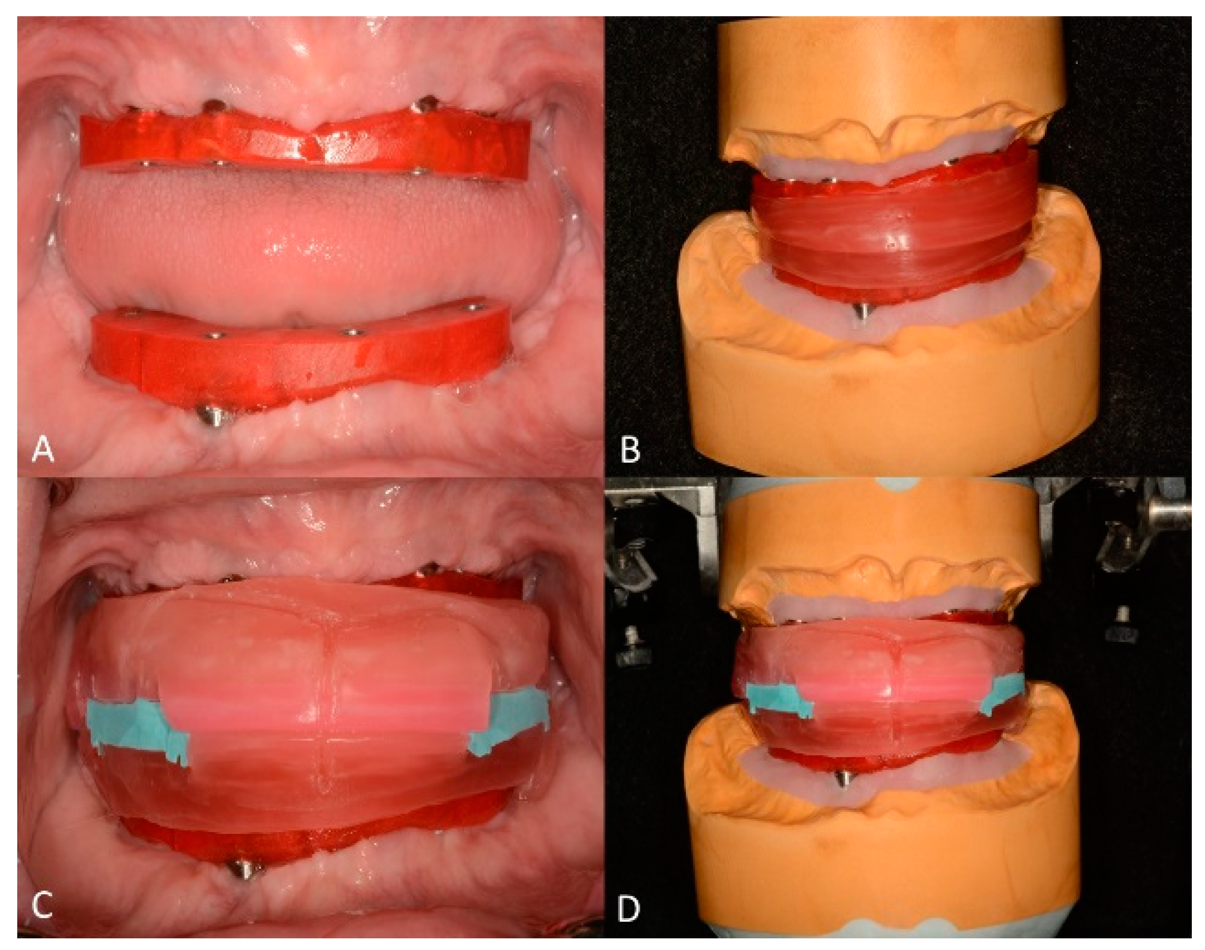 Jfb 14 00174 g005 Jfb 14 00174 g005