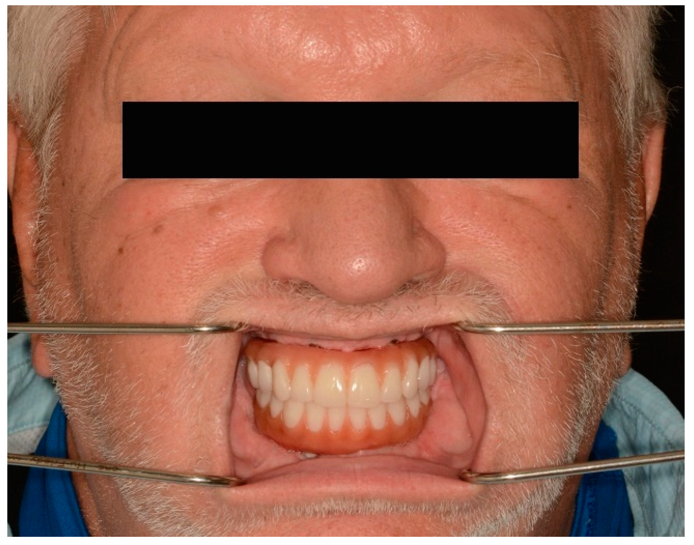 Jfb 14 00174 g007 Jfb 14 00174 g007