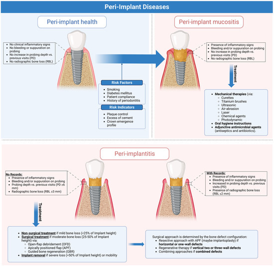 Current Status of Peri-Implant Diseases: A Clinical Review for Evidence