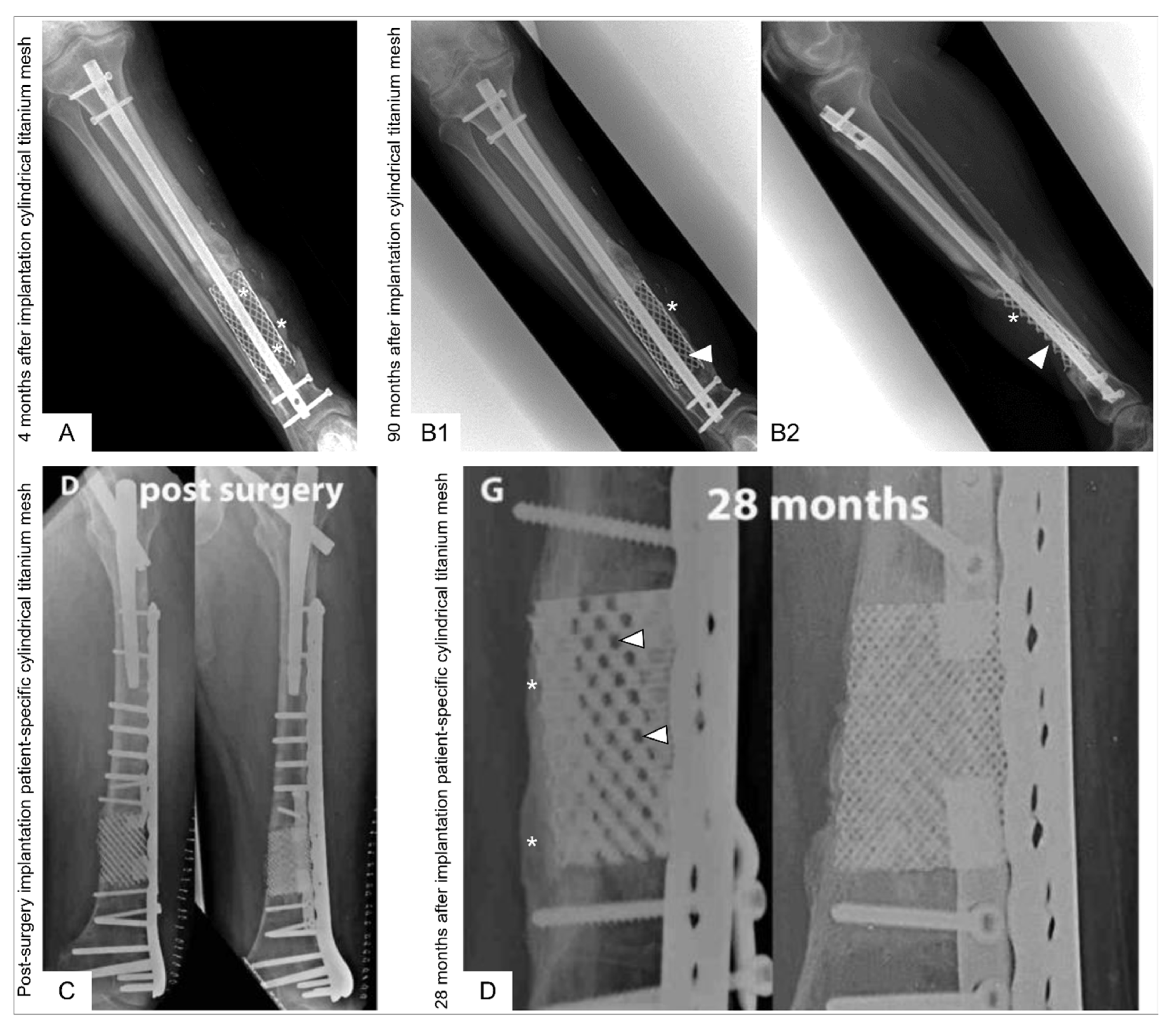 Jfb 14 00341 g005 Jfb 14 00341 g005