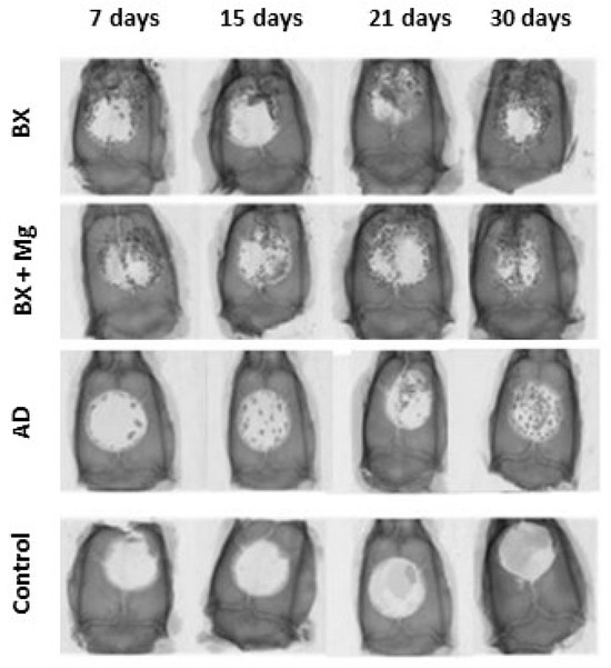 Regeneration of Critical Calvarial Bone Defects Using Bovine Xenograft ...