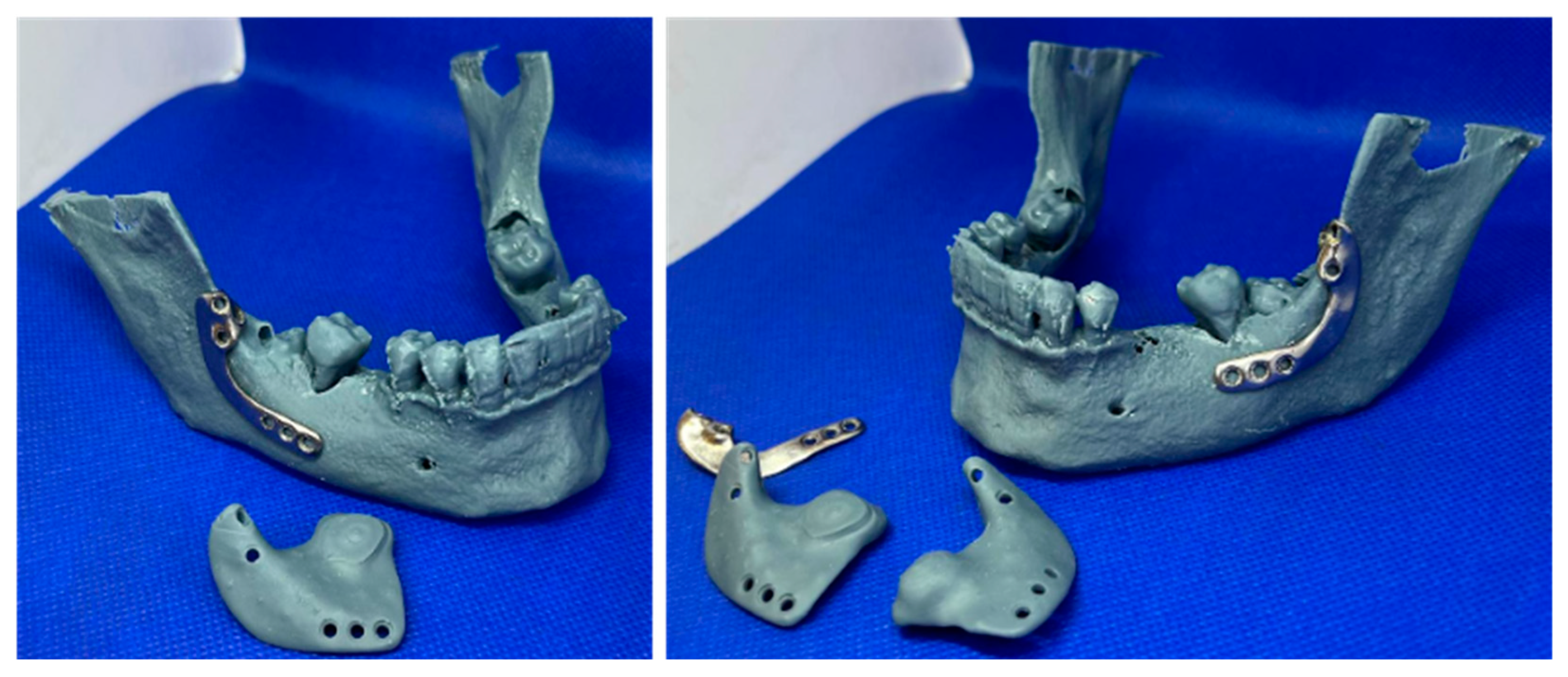 Jfb 16 00064 g004 Jfb 16 00064 g004