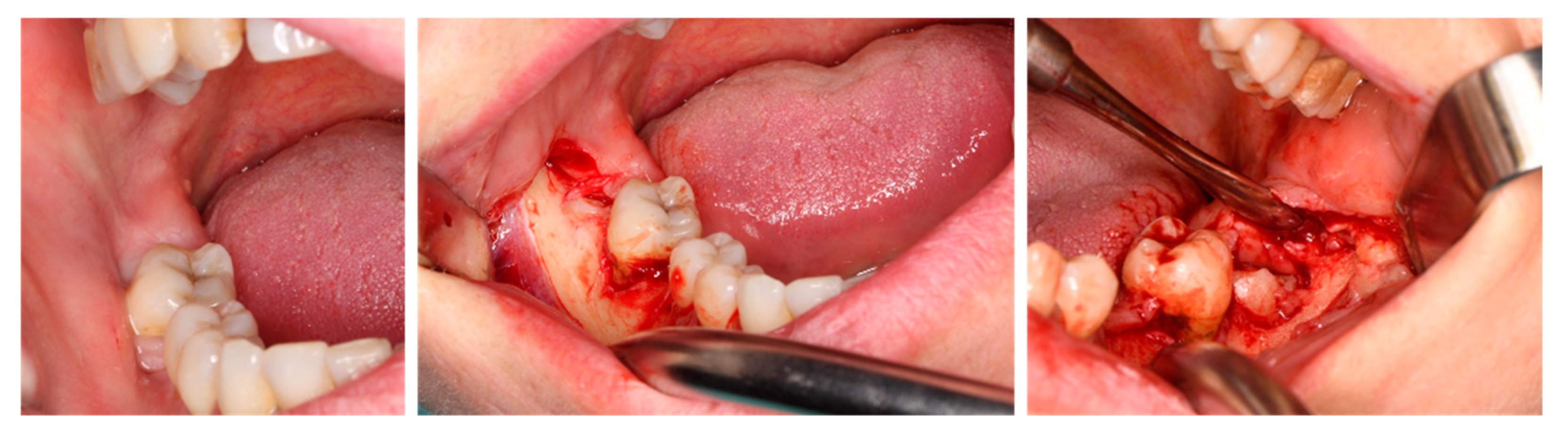 Jfb 16 00064 g005 Jfb 16 00064 g005