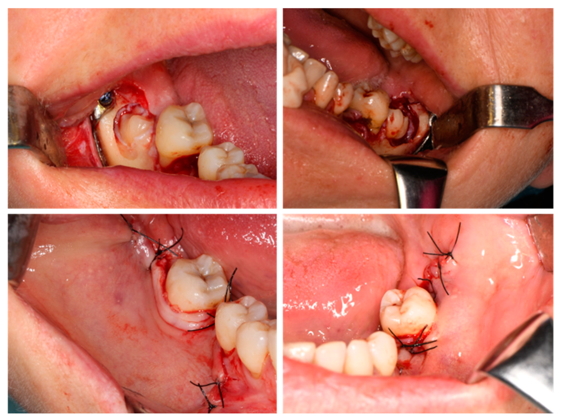 Jfb 16 00064 g007 Jfb 16 00064 g007