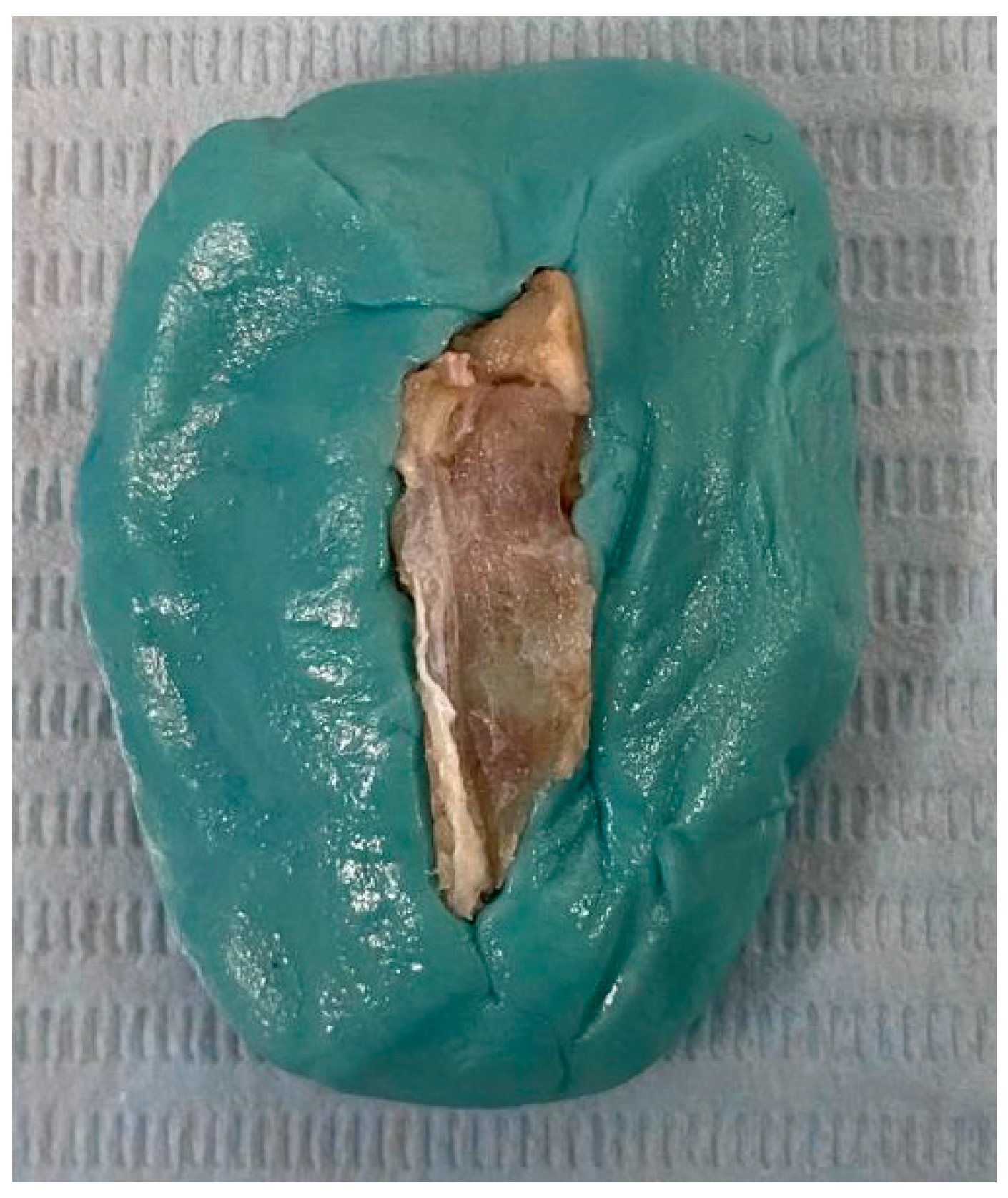 Jfb 16 00146 g005 Jfb 16 00146 g005