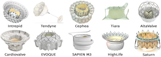 A Novel Self-Expanding Transcatheter Mitral Valve with Dual Annulus ...