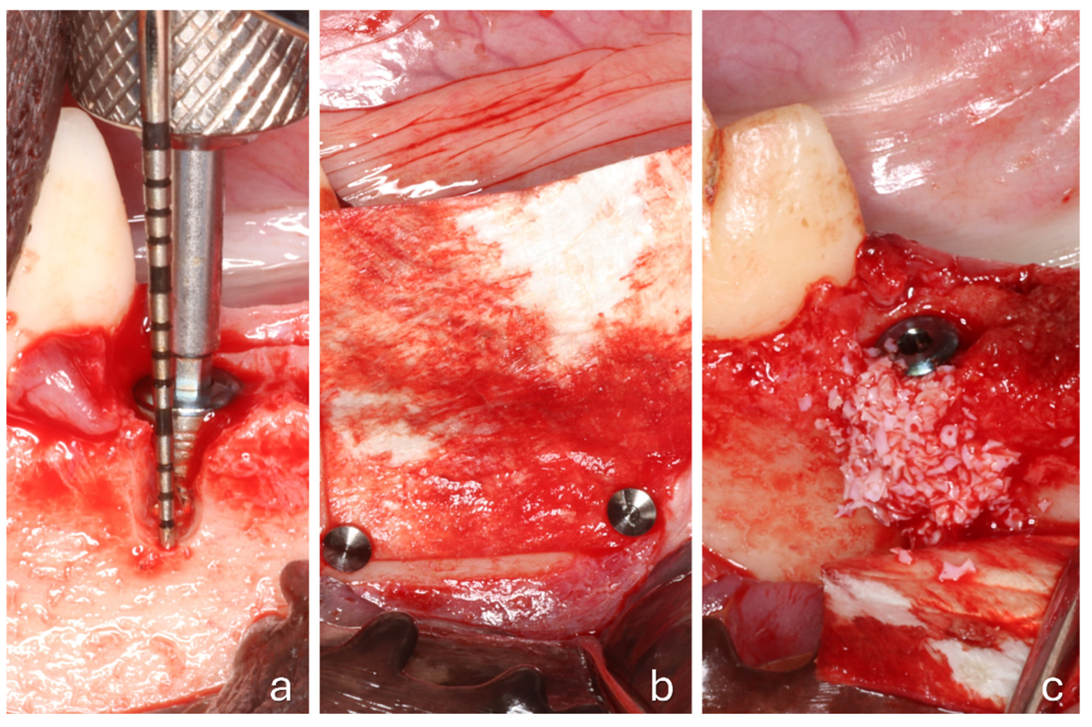 Jfb 16 00281 g002 Jfb 16 00281 g002