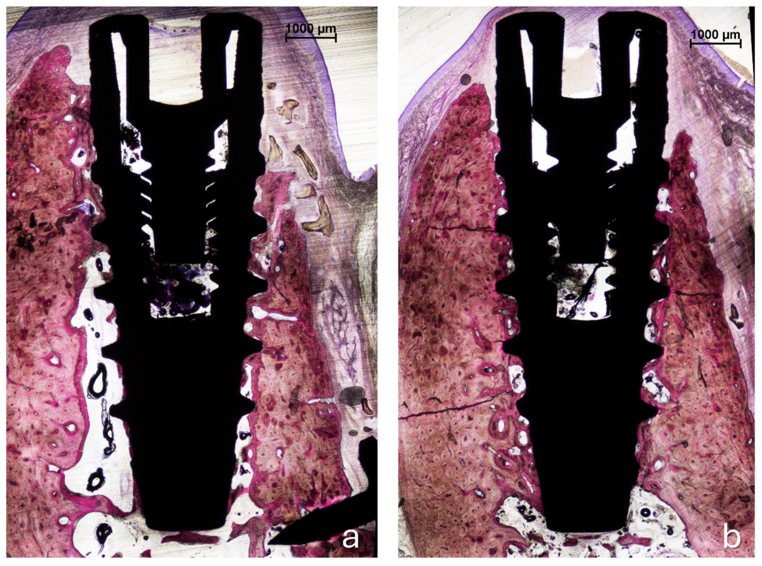 Jfb 16 00281 g004 Jfb 16 00281 g004