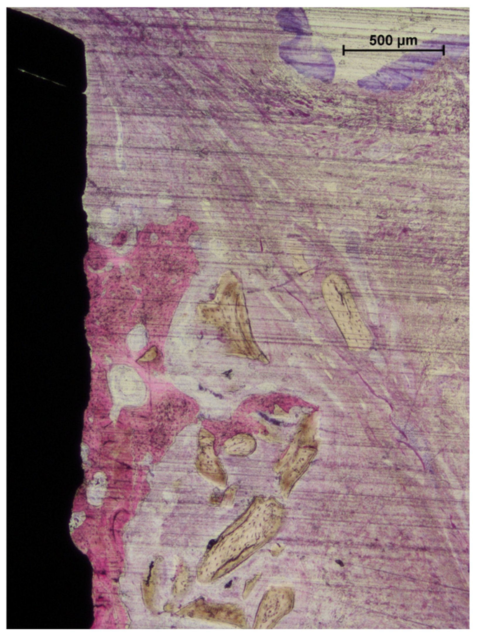 Jfb 16 00281 g005 Jfb 16 00281 g005