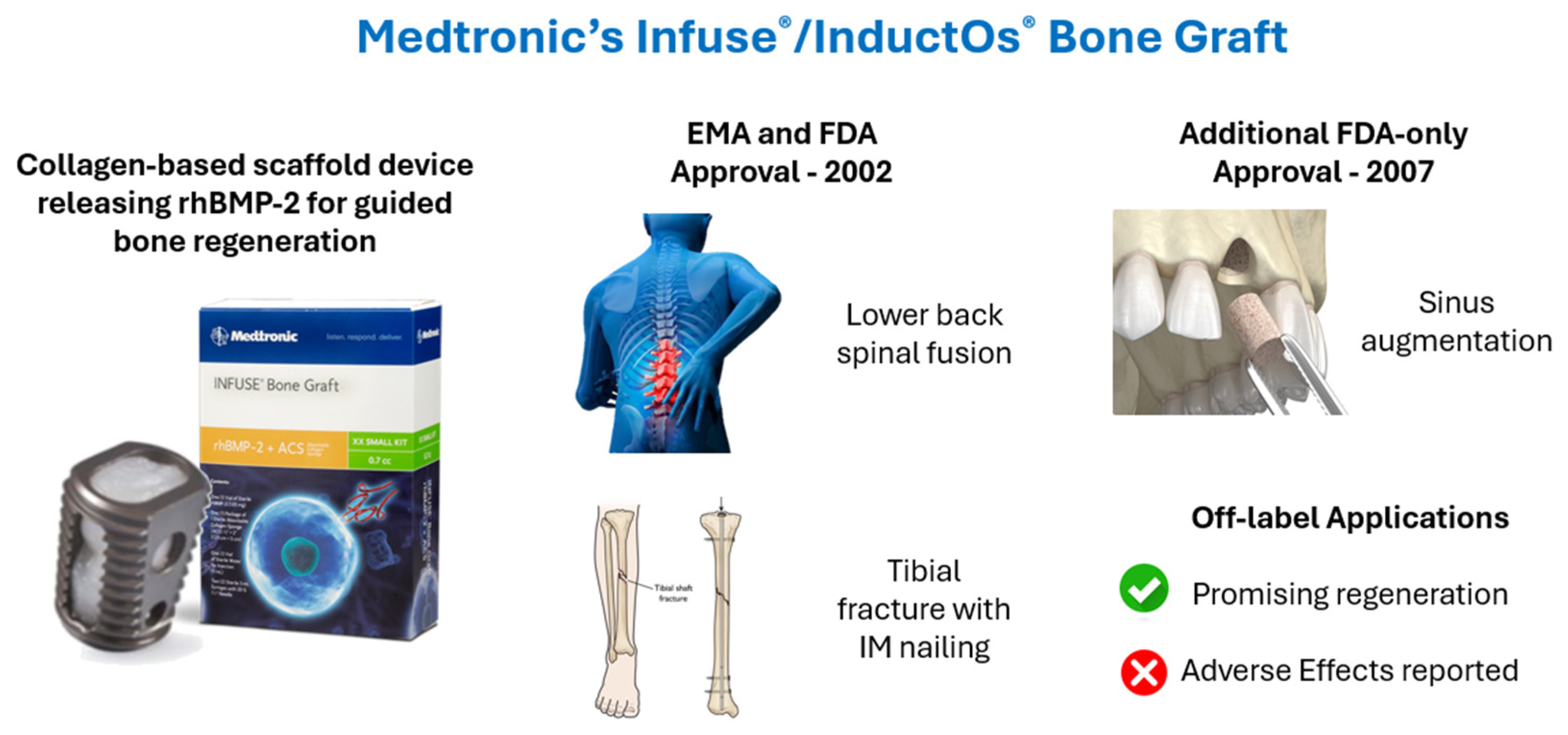 A Critical Review of Commercial Collagen-Based Scaffolds in
