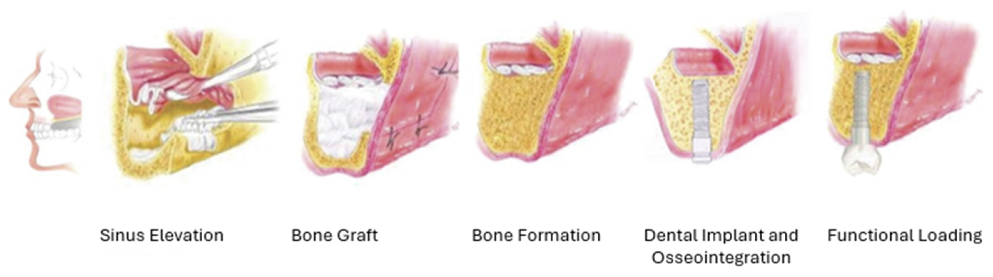 Jfb 16 00313 g005 Jfb 16 00313 g005