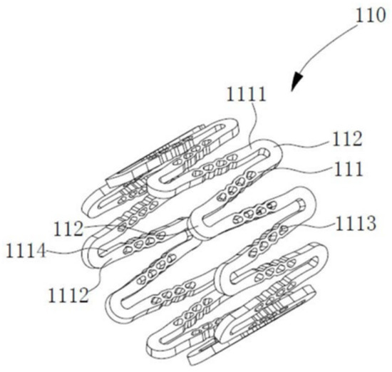 Biodegradable Metal-Based Stents: Advances, Challenges, and Prospects