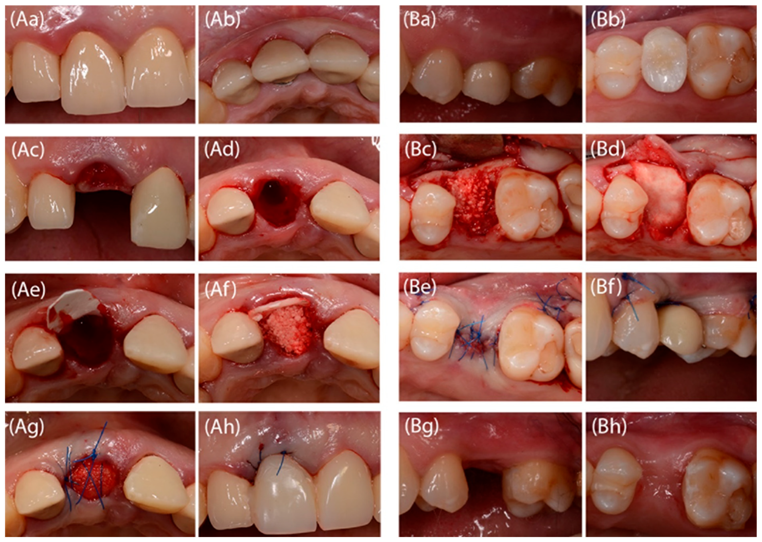 Jfb 16 00345 g003 Jfb 16 00345 g003