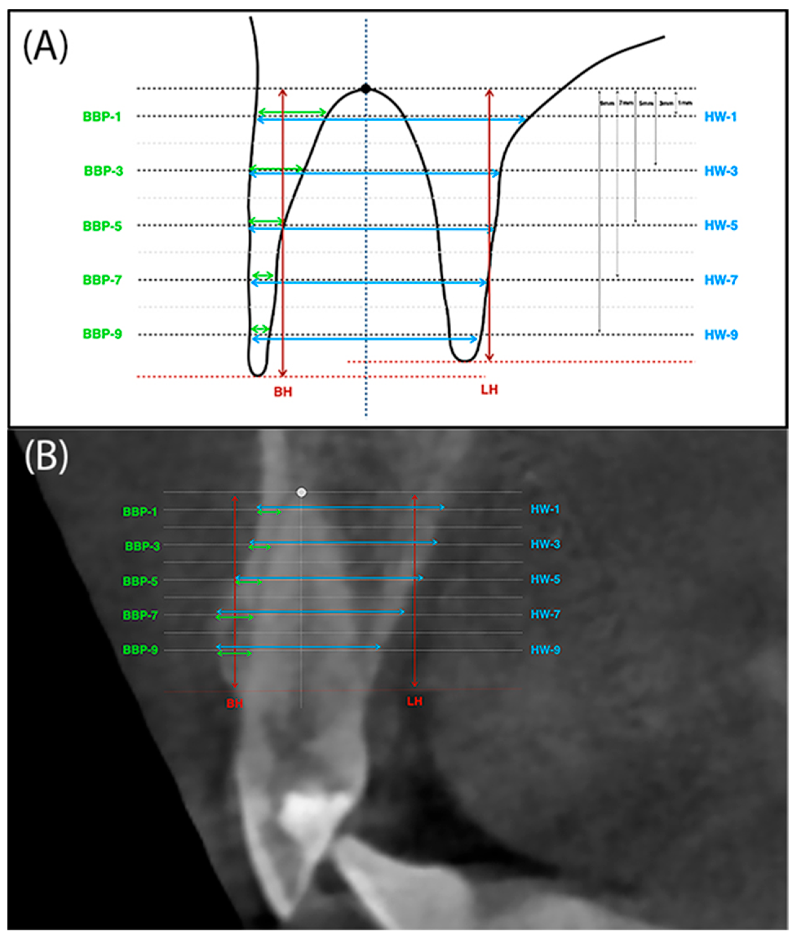 Jfb 16 00345 g004 Jfb 16 00345 g004