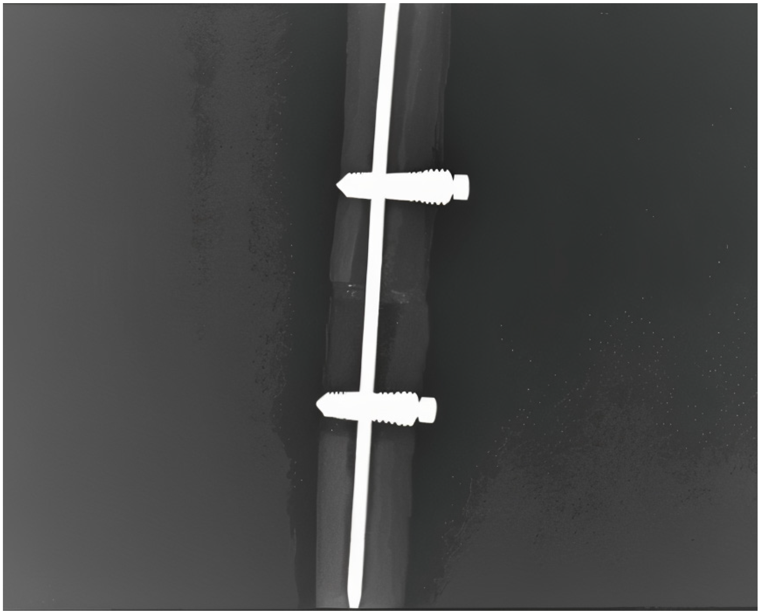 Jfb 16 00348 g005 Jfb 16 00348 g005