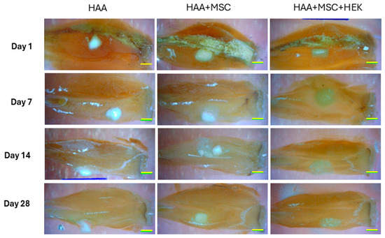 Enhanced Osteogenesis by Combining Exogenous BMPs with