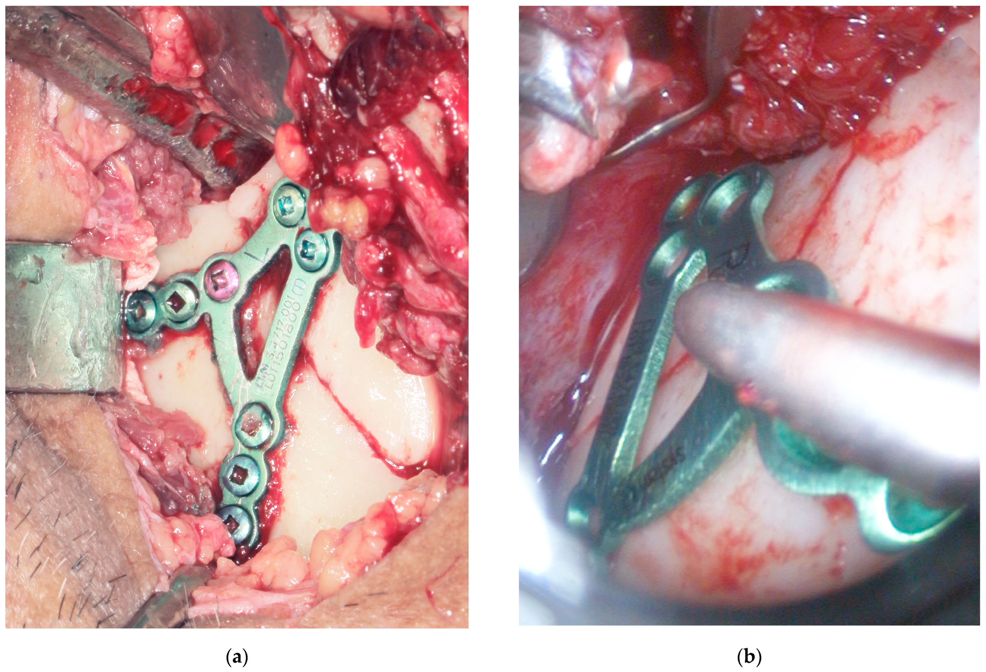 Jfb 16 00382 g002 Jfb 16 00382 g002