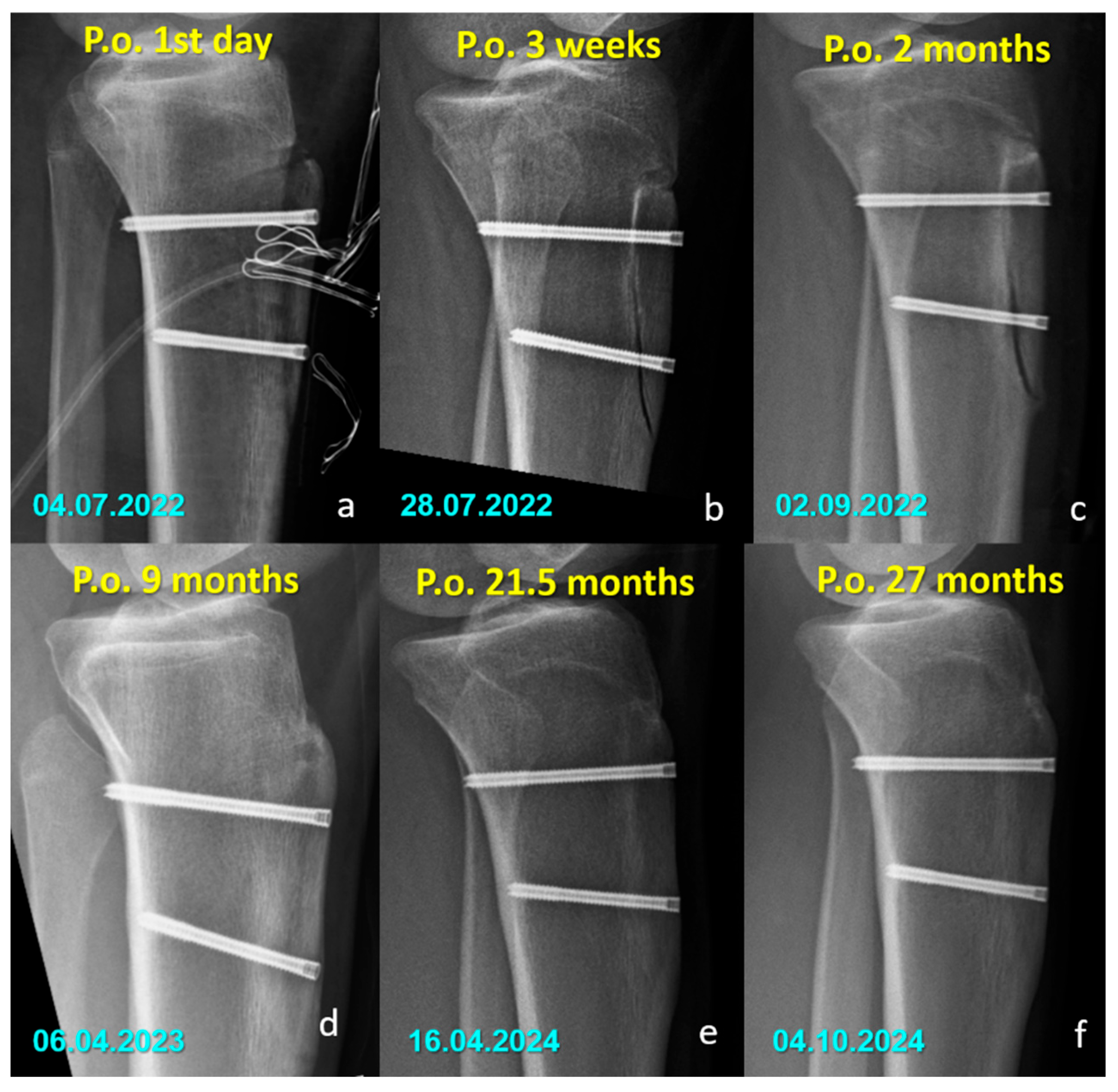 Jfb 16 00404 g003 Jfb 16 00404 g003