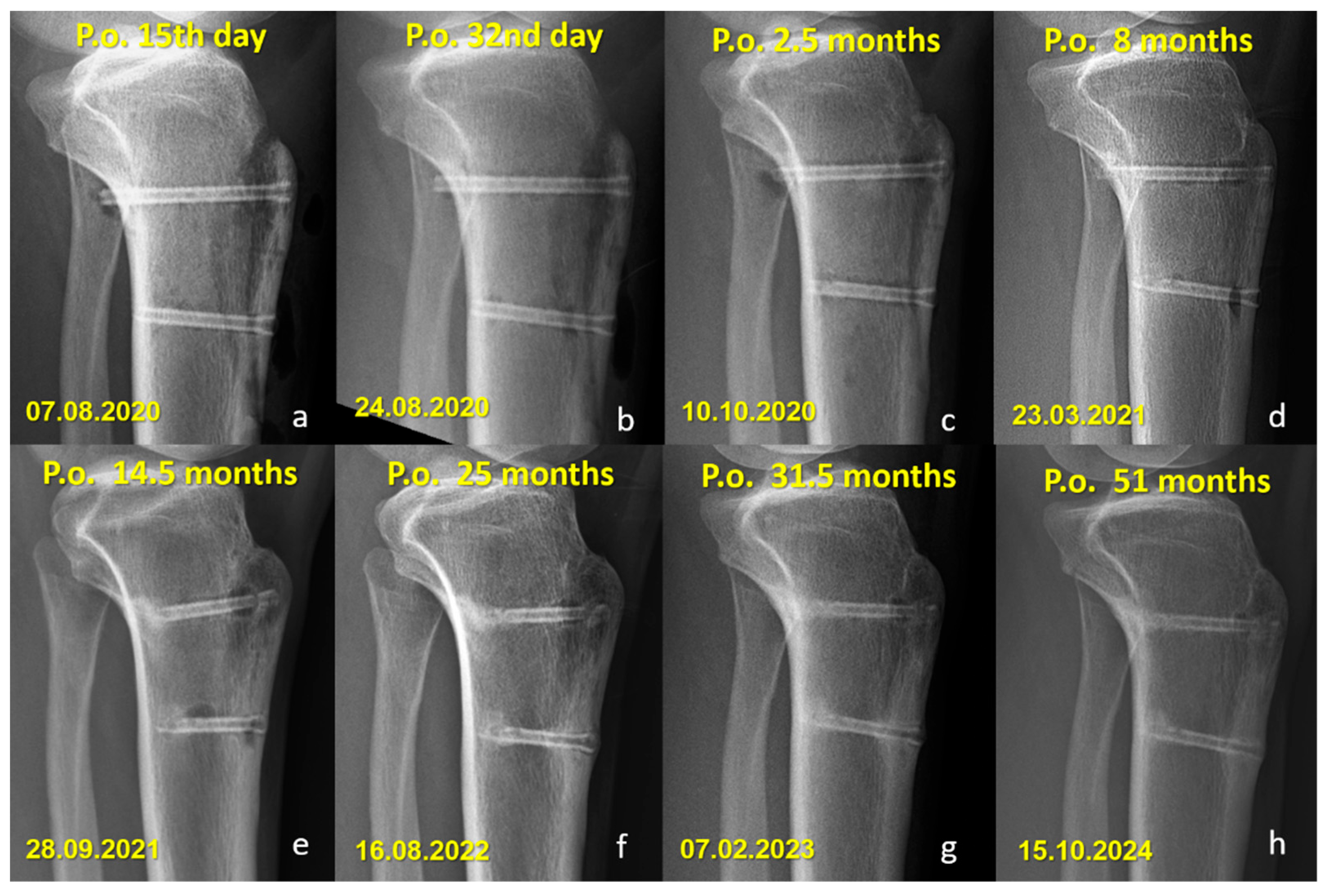 Jfb 16 00404 g004 Jfb 16 00404 g004