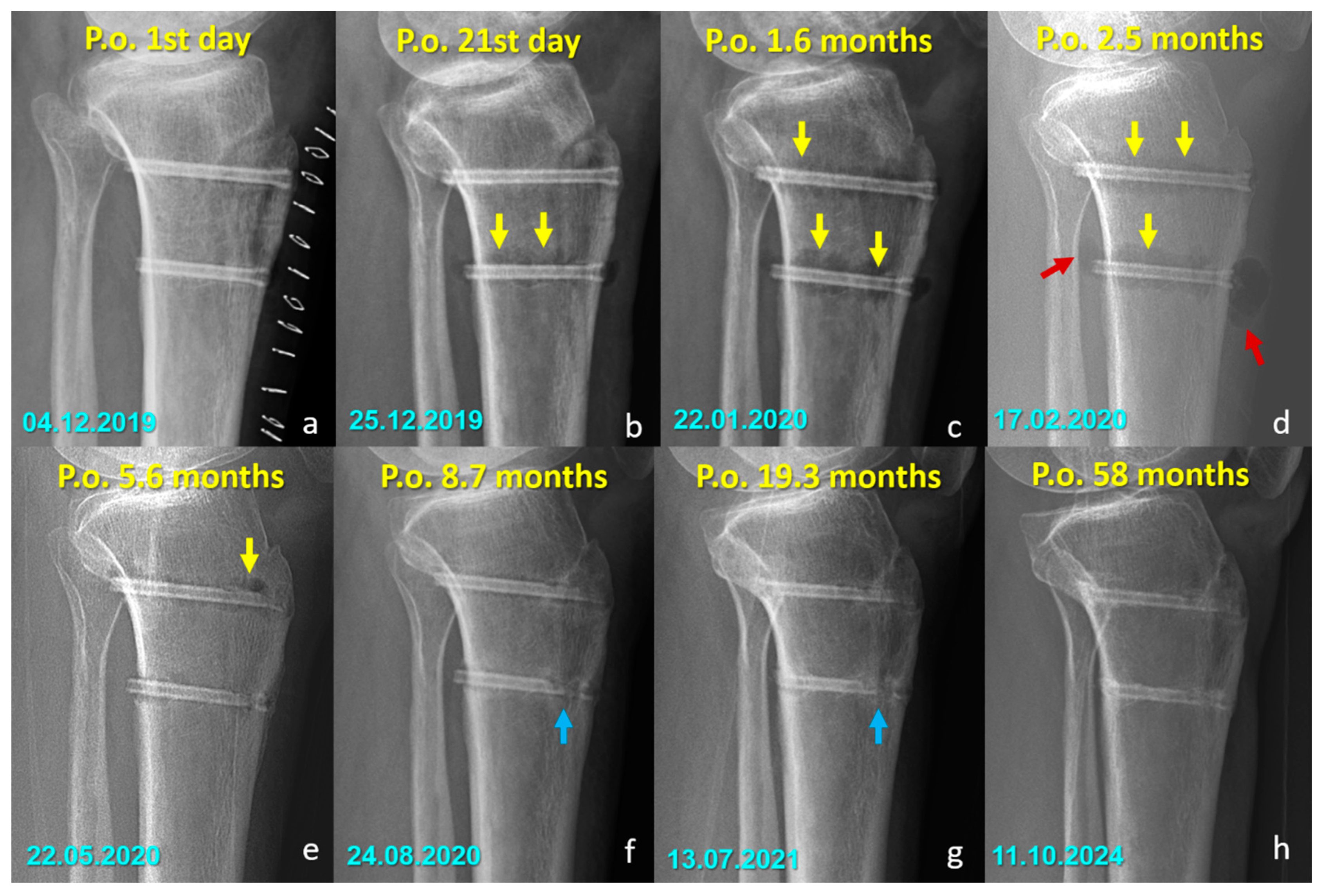 Jfb 16 00404 g005 Jfb 16 00404 g005