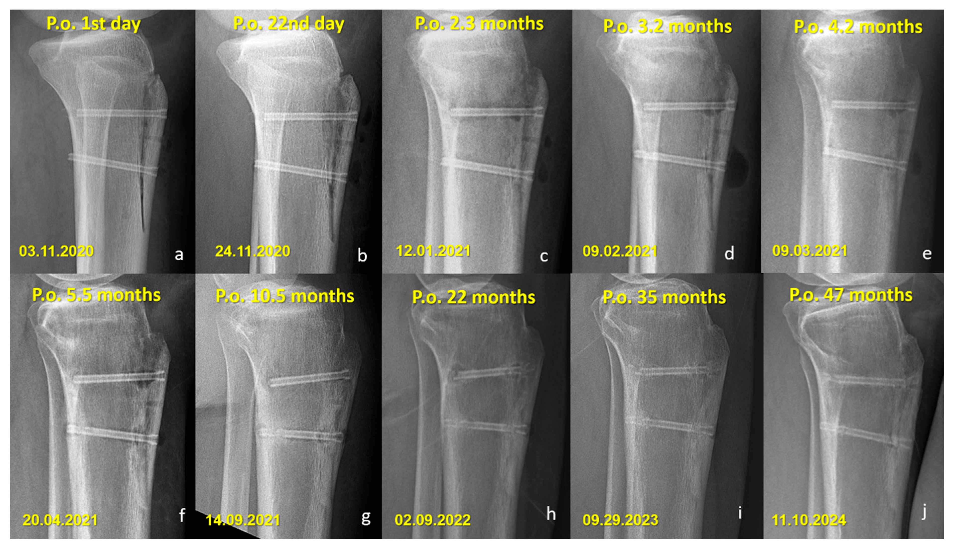 Jfb 16 00404 g006 Jfb 16 00404 g006