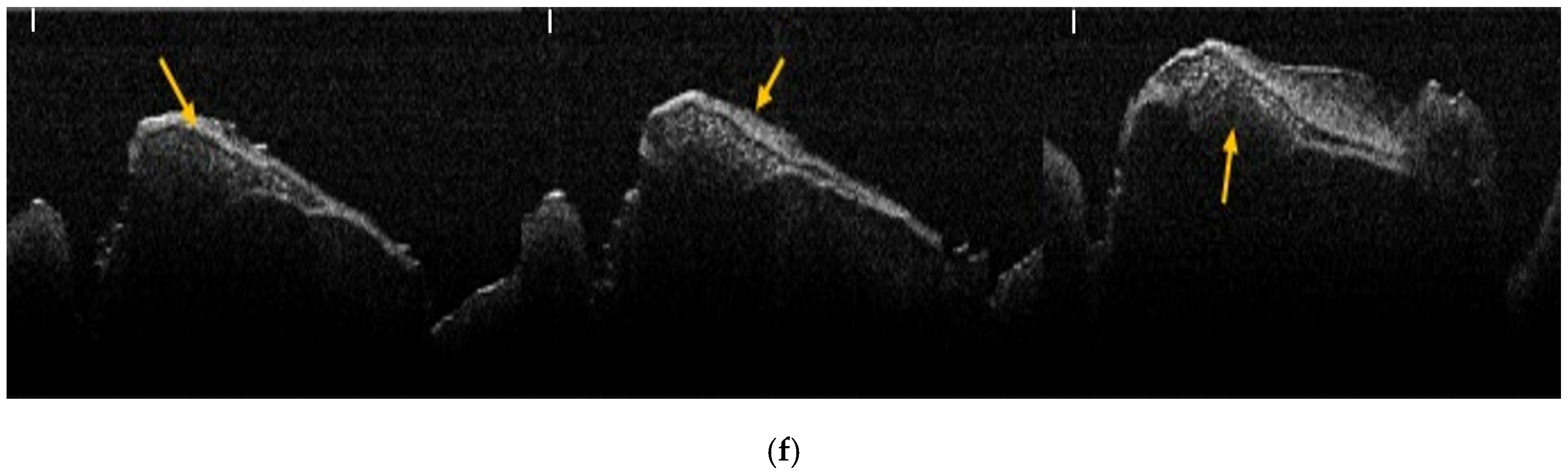 Jfb 17 00026 g002b Jfb 17 00026 g002b