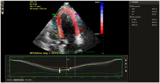 Strain, strain rate and speckle tracking: Myocardial deformation