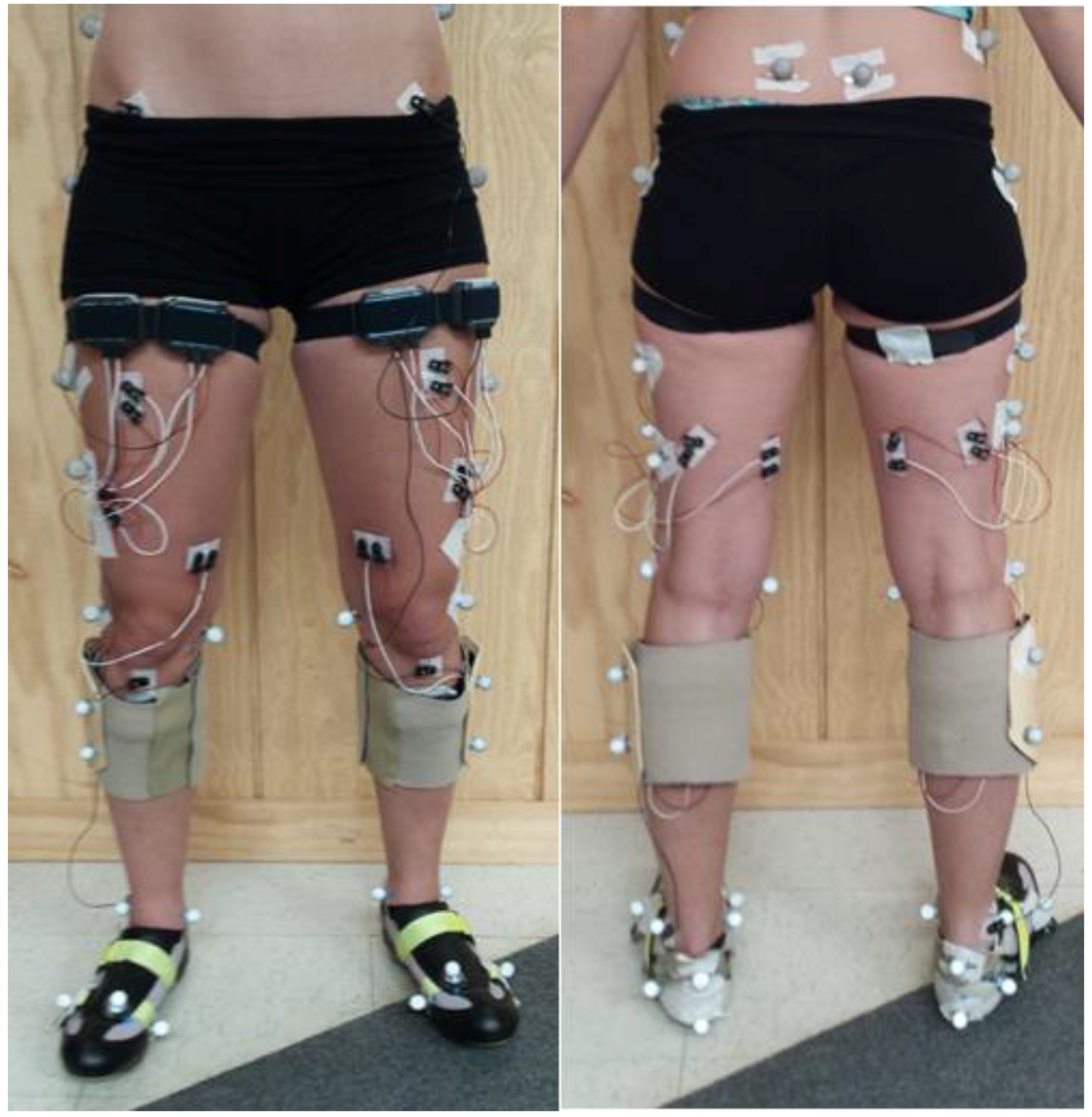 Bow Legs Surgery image 
